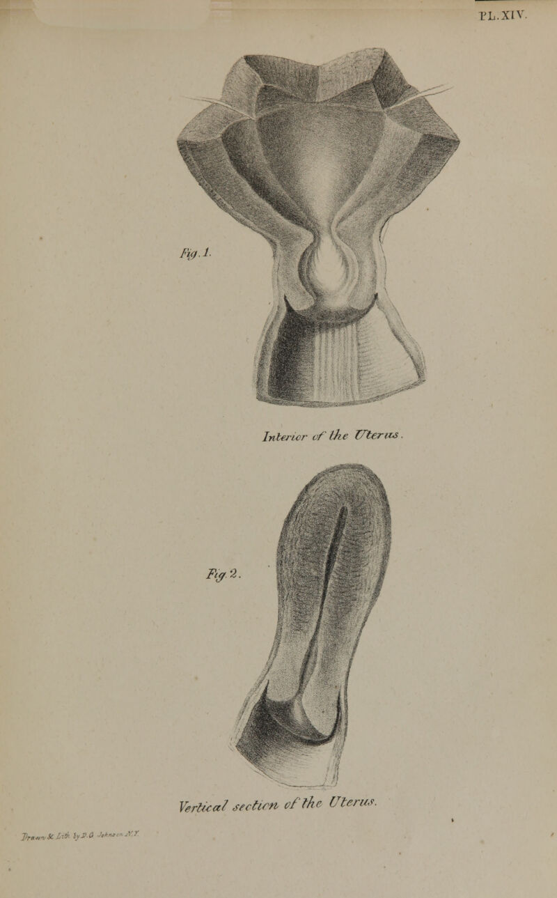 Fuj.L Interior of the Uteris Ft? 2. Vertical section of the Uterus. Dr*»v3c