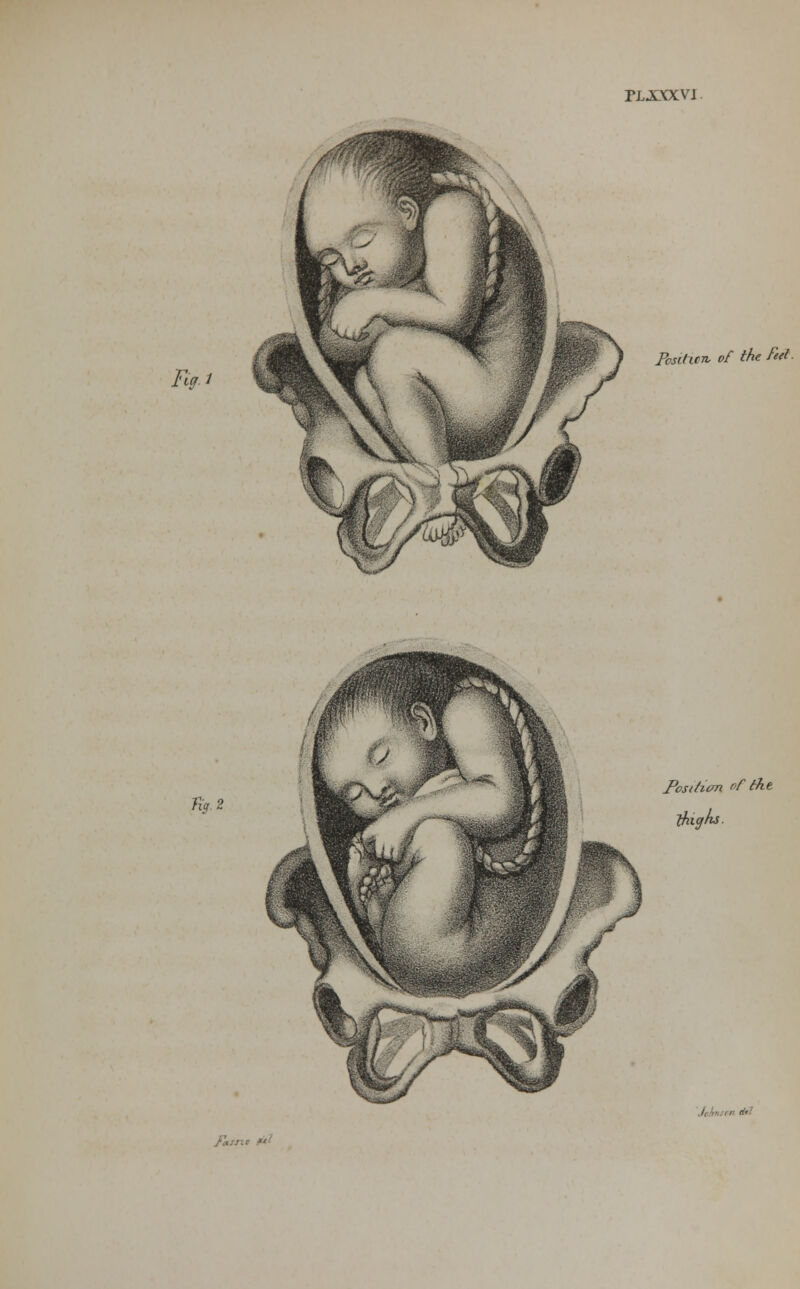 PL.XXXVI Fig. i Posilxcrv of the fed Kg. 2 Posrfum of the thighs