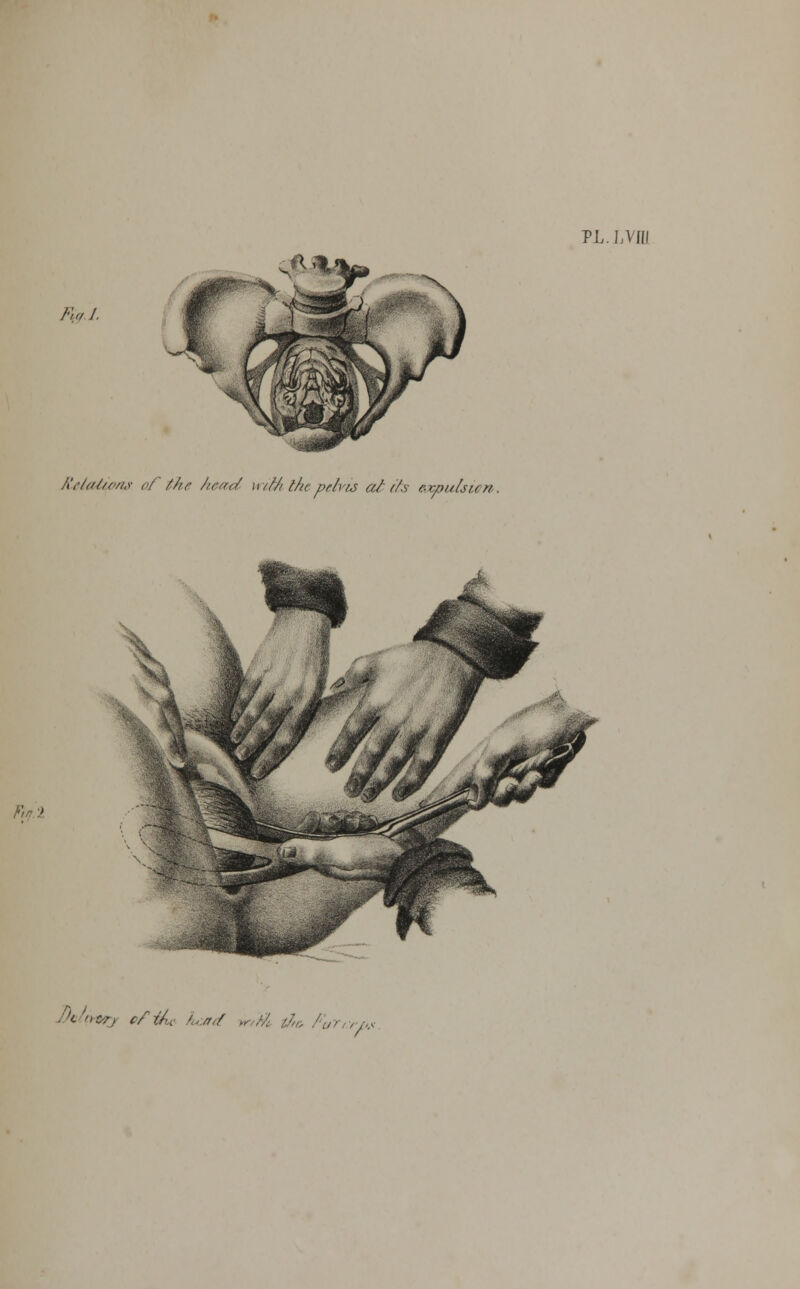 Fial Relations of the head with the pelvis a/ its sxpulsicn. PL. LVII! 7). >. J'cnz-rj c/tAL fcad r/M tie, PuTt:ri#
