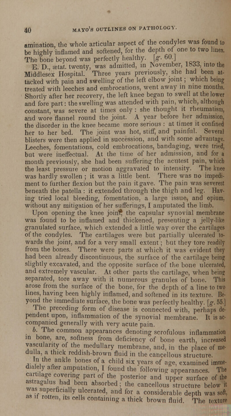 amination, the whole articular aspect of the condyles was found to be highly inflamed and softened, for the depth of one to two lines. The bone beyond was perfectly healthy, [g. 60.] E. D., aetat. twenty, was admitted, in November, 1833. into the Middlesex Hospital. Three years previously, she had been at- tacked with pain and swelling of the left elbow joint; which being treated with leeches and embrocations, went away in nine months. Shortly after her recovery, the left knee began to swell at the lower and fore part: the swelling was attended with pain, which, although constant, was severe at times only : she thought it rheumatism, and wore flannel round the joint. A year before her admission, the disorder in the knee became more serious : at times it confined her to her bed. The joint was hot, stiff, and painful. Several blisters were then applied in succession, and with some advantage. Leeches, fomentations, cold embrocations, bandaging, were tried, but were ineffectual. At the time of her admission, and for a month previously, she had been suffering the acutest pain, which the least pressure or motion aggravated to intensity. The knee was hardly swollen ; it was a little bent. There was no impedi- ment to further flexion but the pain it gave. The pain was severest beneath the patella : it extended through the thigh and leg. Hav- ing tried local bleeding, fomentation, a large issue, and opium. without any mitigation of her sufferings, I amputated the limb. Upon opening the knee joirfr* the capsular synovial membrane was found to be inflamed and thickened, presenting a jelly-like granulated surface, which extended a little way over the cartilages of the condyles. The cartilages were but partially ulcerated to- wards the joint, and for a very small extent; but they tore readily from the bones. There were parts at which it was evident they had been already discontinuous, the surface of the cartilage being slightly excavated, and the opposite surface of the bone ulcerated, and extremely vascular. At other parts the cartilage, when being separated, tore away with it numerous granules of bone. This arose from the surface of the bone, for the depth of a line to two lines, having been highly inflamed, and softened in its texture. Be- yond the immediate surface, the bone was perfectly healthy, [g. 55.] The preceding form of disease is connected with, perhaps de- pendent upon, inflammation of the synovial membrane. It is ac- companied generally with very acute pain. 6. The common appearances denoting scrofulous inflammation in bone, are, softness from deficiency of bone earth, increased vascularity of the medullary membrane, and, in the place of me- dulla, a thick reddish-brown fluid in the cancellous structure. In the ankle bones of a child six years of age, examined imme- diately after amputation, I found the Vollowinjfappearances. The cartilage covering part of the posterior and upper surface of the astragalus had been absorbed; the cancellous structure below it was superficially ulcerated, and for a considerable depth was soft, as it rotten, its cells containing a thick brown fluid. The textuli