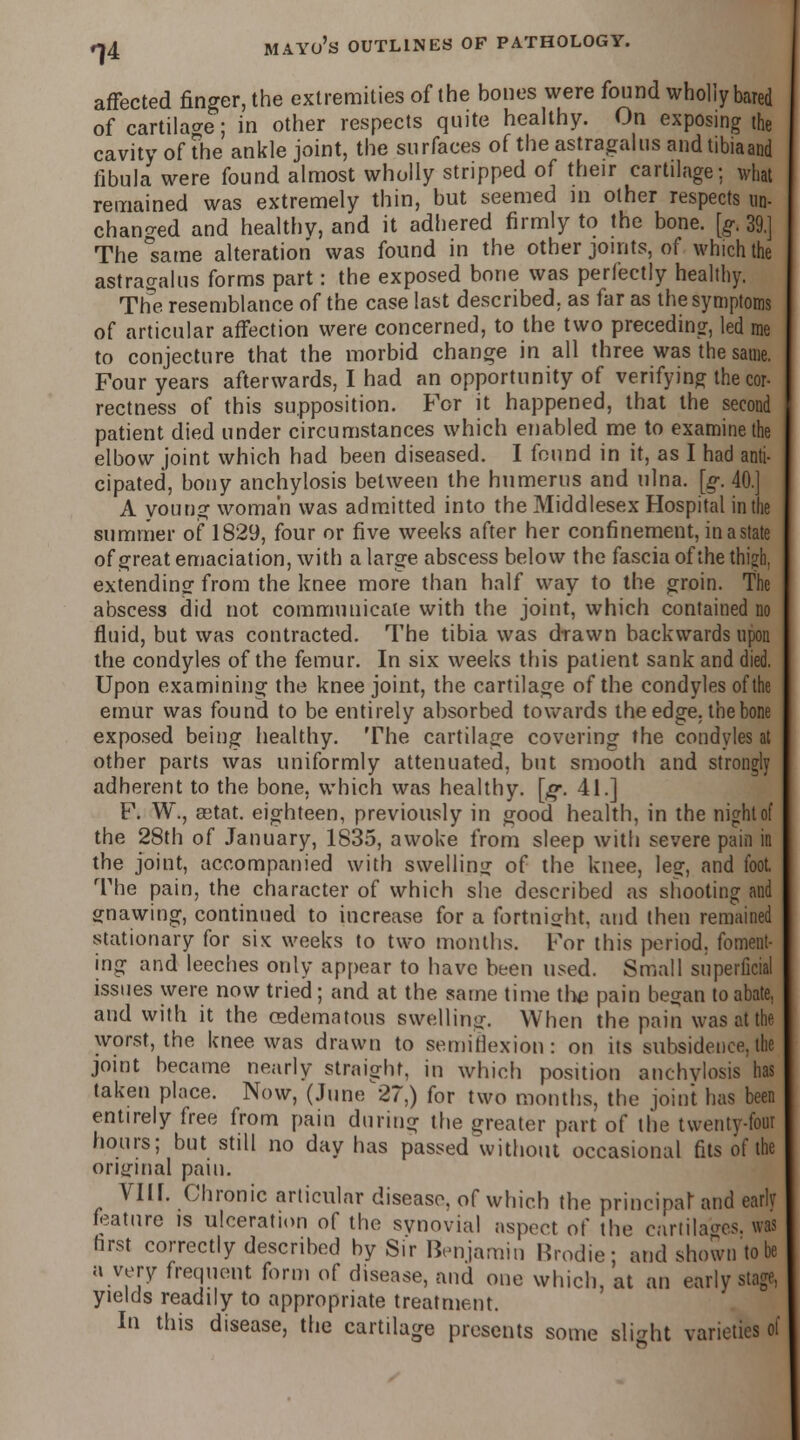 affected finger, the extremities of the bones were found wholly bared of cartilage; in other respects quite healthy. On exposing the cavity of The ankle joint, the surfaces of the astragalus andtibiaand fibula were found almost wholly stripped of their cartilage; what remained was extremely thin, but seemed in other respects un- changed and healthy, and it adhered firmly to the bone. [g. 39.] The same alteration was found in the other joints, of which the astragalus forms part: the exposed bone was perfectly healthy. The resemblance of the case last described, as far as the symptoms of articular affection were concerned, to the two preceding, led me to conjecture that the morbid change in all three was the same. Four years afterwards, I had an opportunity of verifying the cor- rectness of this supposition. For it happened, that the second patient died under circumstances which enabled me to examine the elbow joint which had been diseased. I found in it, as I had anti- cipated, bony anchylosis between the humerus and ulna. [g. 40.] A young woman was admitted into the Middlesex Hospital in the summer of 1829, four or five weeks after her confinement, inastate of great emaciation, with a large abscess below the fascia of the thigh, extending from the knee more than half way to the groin. The abscess did not communicate with the joint, which contained no fluid, but was contracted. The tibia was drawn backwards upon the condyles of the femur. In six weeks this patient sank and died. Upon examining the knee joint, the cartilage of the condyles of the emur was found to be entirely absorbed towards the edge, the bone exposed being healthy. The cartilage covering the condyles at other parts was uniformly attenuated, but smooth and strongly adherent to the bone, which was healthy, [g. 41.] F. W., eetat. eighteen, previously in good health, in the night of the 28th of January, 1835, awoke from sleep with severe pain in the joint, accompanied with swelling of the knee, leg, and foot. The pain, the character of which she described as shooting and gnawing, continued to increase for a fortnight, and then remained stationary for six weeks to two months. For this period, foment- ing and leeches only appear to have been used. Small superficial issues were now tried ; and at the same time tho pain began to abate, and with it the (Edematous swelling. When the pain was at the worst, the knee was drawn to semiflexion: on its subsidence, the joint became nearly straight, in which position anchylosis has taken place. Now, (June 27,) for two months, the joint has been entirely free from pain during the greater part of the twenty-four hours; but still no day has passed without occasional fits of the original pain. VIU. Chronic articular disease, of which the principal and early feature is ulceration of the synovial aspect of the cartilages, was first correctly described by Sir Benjamin Rrodie; and shown to be a very frequent form of disease, and one which, at an early stage, yields readily to appropriate treatment. In this disease, the cartilage presents some slight varieties of