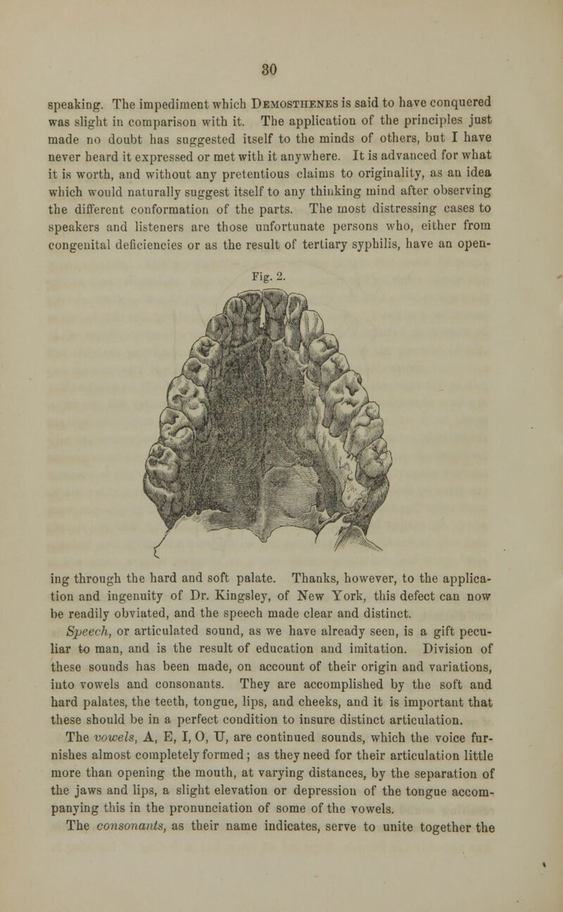 speaking. The impediment which Demosthenes is said to have conquered was slight in comparison with it. The application of the principles just made no doubt has suggested itself to the minds of others, but I have never heard it expressed or met with it anywhere. It is advanced for what it is worth, and without any pretentious claims to originality, as an idea which would naturally suggest itself to any thinking mind after observing the different conformation of the parts. The most distressing cases to speakers and listeners are those unfortunate persons who, either from congenital deficiencies or as the result of tertiary syphilis, have an open- ing through the hard and soft palate. Thanks, however, to the applica- tion and ingenuity of Dr. Kingsley, of New York, this defect can now be readily obviated, and the speech made clear and distinct. Speech, or articulated sound, as we have already seen, is a gift pecu- liar to man, and is the result of education and imitation. Division of these sounds has been made, on account of their origin and variations, into vowels and consonants. They are accomplished by the soft and hard palates, the teeth, tongue, lips, and cheeks, and it is important that these should be in a perfect condition to insure distinct articulation. The vowels, A, E, I, 0, U, are continued sounds, which the voice fur- nishes almost completely formed; as they need for their articulation little more than opening the mouth, at varying distances, by the separation of the jaws and lips, a slight elevation or depression of the tongue accom- panying this in the pronunciation of some of the vowels. The consonants, as their name indicates, serve to unite together the