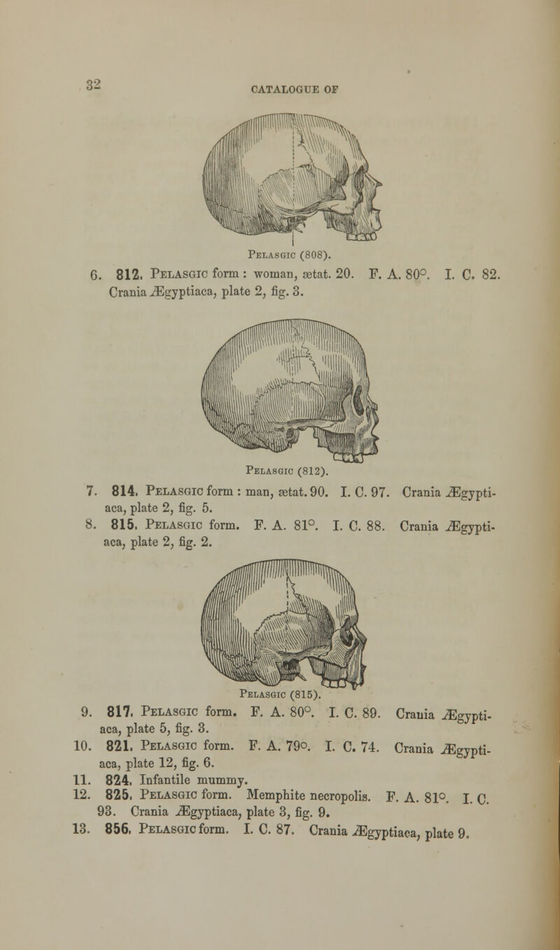 CATALOGUE OF Pelasgic (808). 6. 812. Pelasgic form : woman, aetat. 20. F. A. 80°. I. C. 82. Crania JEgyptiaca, plate 2, fig. 3. Pelasgic (812). 7. 814. Pelasgic form: man, aetat. 90. I. C. 97. Crania iEgypti- aca, plate 2, fig. 5. 8. 815. Pelasgic form. F. A. 81°. I. C. 88. Crania ^Egypti- aca, plate 2, fig. 2. Pelasgic (815). 9. 817. Pelasgic form. F. A. 80°. I. C. 89. Crania iEgypti- aca, plate 5, fig. 3. 10. 821. Pelasgic form. F. A. 79o. I. C. 74. Crania JEgypti- aca, plate 12, fig. 6. 11. 824. Infantile mummy. 12. 825. Pelasgic form. Memphite necropolis. F. A. 81°. I. C. 93. Crania iEgyptiaca, plate 3, fig. 9. 13. 856. Pelasgic form. I. C. 87. Crania JEgyptiaca, plate 9.