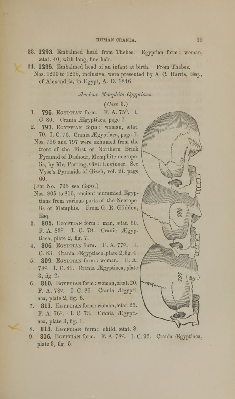 ilBMteis- 33. 1293. Embalmed head from Thebes. Egyptian form : woman, aetat. 40, with long, fine hair. 34. 1295. Embalmed head of an infant at birth. From Thebes. Nos. 1290 to 1295, inclusive, were presented by A. 0. Harris, Esq., of Alexandria, in Egypt, A. D. 1846. Ancient Memphite Egyptians. (Case 3.) 1. 796. Egyptian form. F. A. 75°. I. C 80. Crania iEgyptiaca, page 7. 2. 797. Egyptian form : woman, aetat. 70. I. C. 76. Crania iEgyptiaca, page 7. Nos. 796 and 797 were exhumed from the front of the First or Northern Brick Pyramid of Dashour, Memphite necropo- lis, by Mr. Perring, Civil Engineer. See Vyse's Pyramids of Grizeh, vol. iii. page 60. (For No. 795 see Copts.) Nos. 805 to 816, ancient mummied Egyp- tians from various parts of the Necropo- lis of Memphis. From Gr. K. Gliddon, Esq. 3. 805. Egyptian form : man, aetat. 50. F. A. 83°. I. C. 79. Crania IEgyp- tiaca, plate 2, fig. 7. 4. 806. Egyptian form. F. A. 77°. I. C. 83. Crania iEgyptiaca, plate 2, fig. 4. 5. 809. Egyptian form : woman. F. A. 78°. I. C 81. Crania iEgyptiaca, plate 3, fig. 2. 6. 810. Egyptian form: woman, aetat. 20. F. A. 78o. I. C. 86. Crania iEgypti- aca, plate 2, fig. 6. 7. 811. Egyptian form: woman, aetat. 25. F. A. 76°. ■ I. C. 73. Crania iEgypti- aca, plate 3, fig. 1. 8. 813. Egyptian form: child, astat. 8. plate 3, fig. 5.