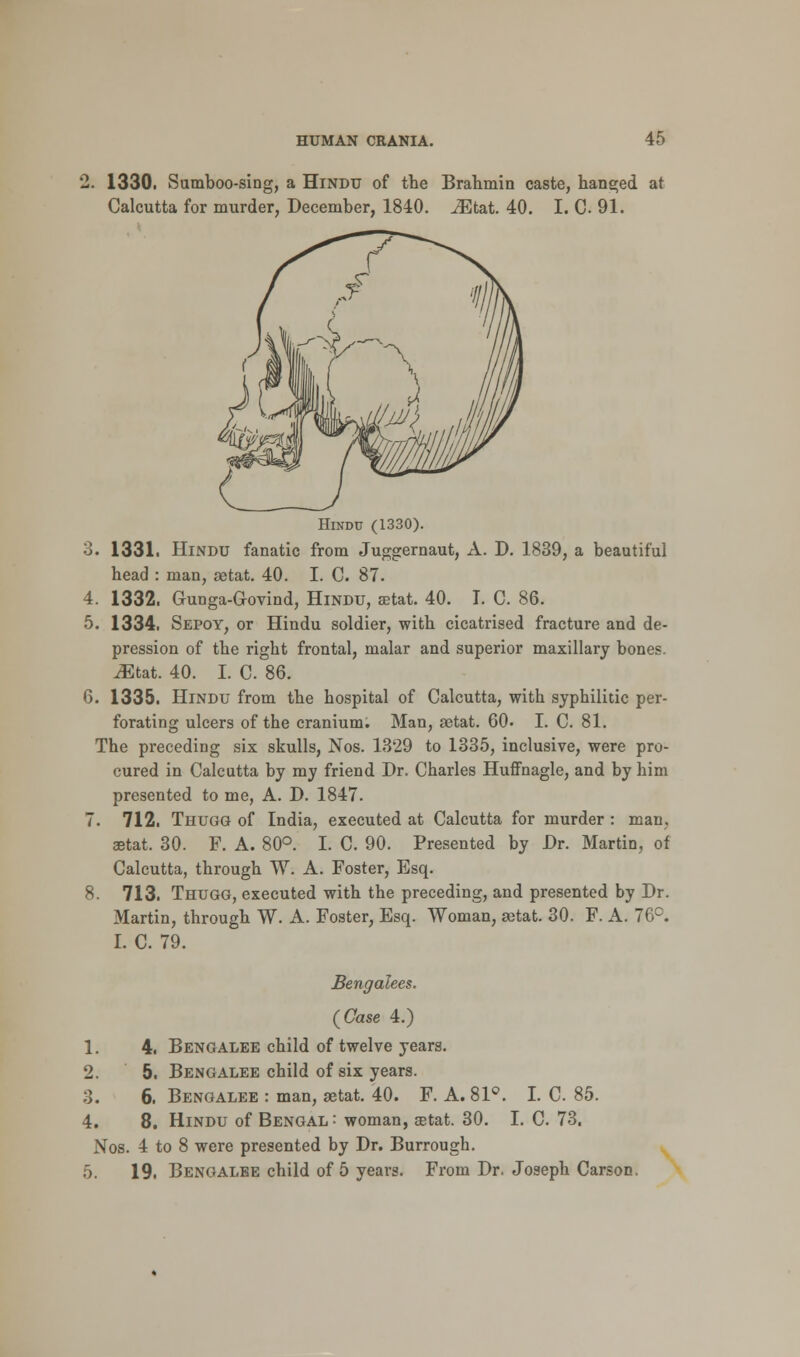 2. 1330. Sumboo-sing, a Hindu of the Brahmin caste, hanged at Calcutta for murder, December, 1840. iEtat. 40. I. C 91. Hindu (1330). 3. 1331. Hindu fanatic from Juggernaut, A. D. 1839, a beautiful head : man, setat. 40. I. C. 87. 4. 1332. Gunga-G-ovind, Hindu, aetat. 40. I. C. 86. 5. 1334. Sepoy, or Hindu soldier, with cicatrised fracture and de- pression of the right frontal, malar and superior maxillary bones. ^Etat. 40. I. C 86. 6. 1335. Hindu from the hospital of Calcutta, with syphilitic per- forating ulcers of the cranium. Man, setat. 60. I. C. 81. The preceding six skulls, Nos. 1329 to 1335, inclusive, were pro- cured in Calcutta by my friend Dr. Charles Huffnagle, and by him presented to me, A. D. 1847. 7. 712. Thugg of India, executed at Calcutta for murder : man, aetat. 30. F. A. 80°. I. C. 90. Presented by Dr. Martin, of Calcutta, through W. A. Foster, Esq. 8. 713. Thugg, executed with the preceding, and presented by Dr. Martin, through W. A. Foster, Esq. Woman, setat. 30. F. A. 76°. I. C. 79. Bengalees. (Case 4.) 4. Bengalee child of twelve years. 5. Bengalee child of six years. 6. Bengalee : man, setat. 40. F. A. 81°. 8. Hindu of Bengal : woman, aetat. 30. Nos. 4 to 8 were presented by Dr. Burrough. 5. 19. Bengalee child of 5 years. From Dr. Joseph Carson. I. C. 85. I. C. 73.