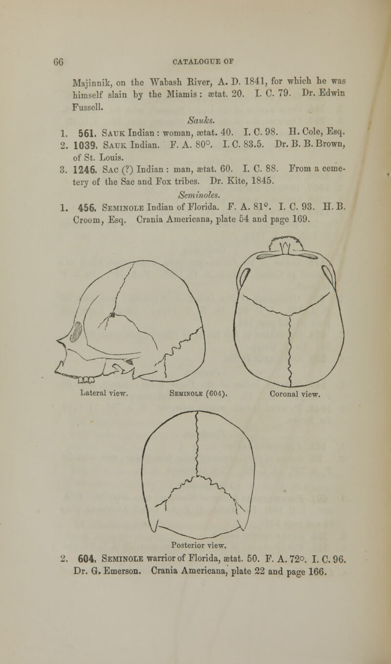 Majinnik, on the Wabash Kiver, A. D. 1841, for which he was himself slain by the Miamis : aetat. 20. I. C. 79. Dr. Edwin Fussell. Sauks. 1. 561. Sauk Indian : woman, aetat. 40. I. C. 98. H. Cole, Esq. 2. 1039. Sauk Indian. F. A. 80°. I. C. 83.5. Dr. B. B. Brown, of St. Louis. 3. 1246. Sac (?) Indian : man, setat. 60. I. C. 88. From a ceme- tery of the Sac and Fox tribes. Dr. Kite, 1845. Seminoles. 1. 456. Seminole Indian of Florida. F. A. 81°. I. C 93. H. B. Croom, Esq. Crania Americana, plate 54 and page 169. Lateral view. Seminole (604). Coronal view. Posterior view. 2. 604. Seminole warrior of Florida, setat. 50. F. A. 72°. I. C. 96. Dr. Gr. Emerson. Crania Americana, plate 22 and page 166.