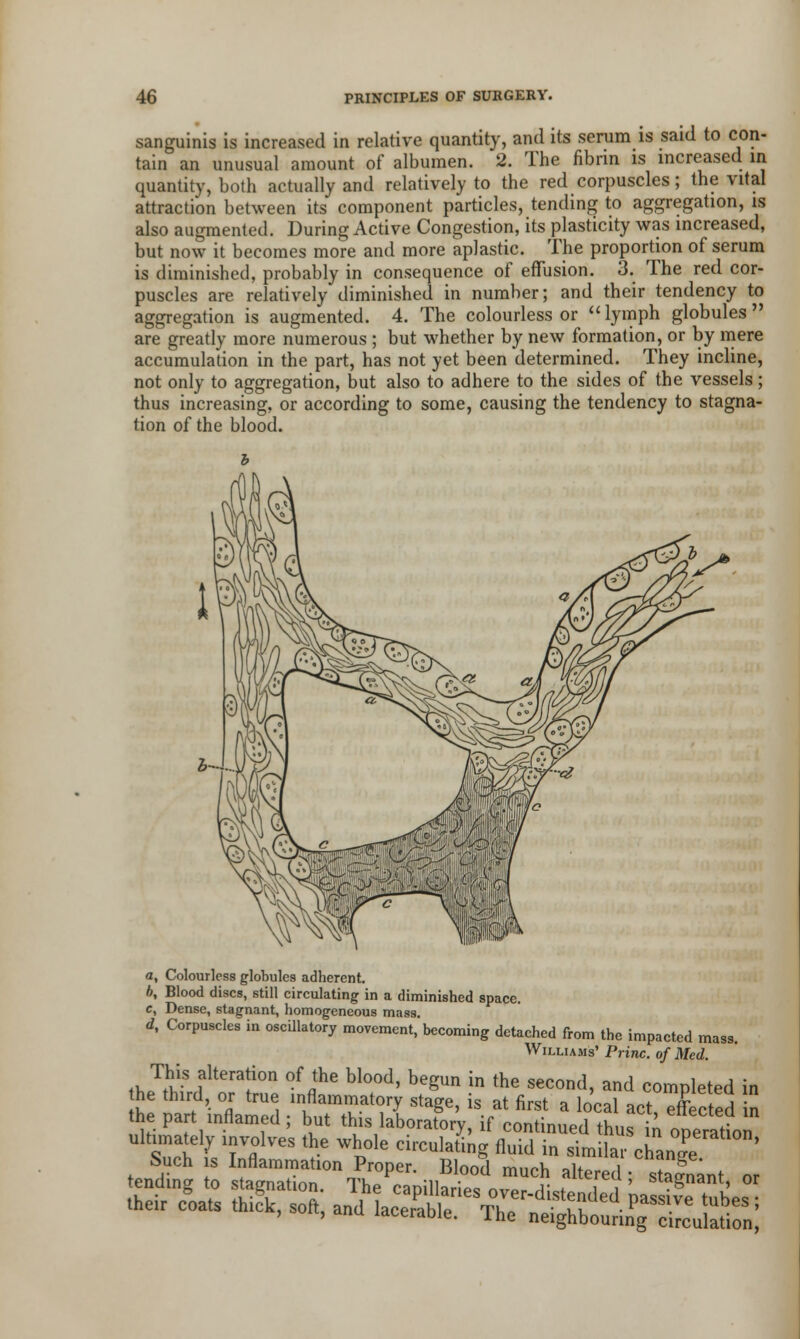 sanguinis is increased in relative quantity, and its serum is said to con- tain an unusual amount of albumen. 2. The fibrin is increased in quantity, both actually and relatively to the red corpuscles; the vital attraction between its component particles, tending to aggregation, is also augmented. During Active Congestion, its plasticity was increased, but now it becomes more and more aplastic. The proportion of serum is diminished, probably in consequence of effusion. 3. The red cor- puscles are relatively diminished in number; and their tendency to aggregation is augmented. 4. The colourless or lymph globules are greatly more numerous ; but whether by new formation, or by mere accumulation in the part, has not yet been determined. They incline, not only to aggregation, but also to adhere to the sides of the vessels; thus increasing, or according to some, causing the tendency to stagna- tion of the blood. a, Colourless globules adherent. b, Blood discs, still circulating in a diminished space. c, Dense, stagnant, homogeneous mass. d, Corpuscles in oscillatory movement,'becoming detached from the impacted mass. Williams' Princ. of Med. This alteration of the blood, begun in the second, and completed in he third, or true inflammatory stage, is at first a local act effected n he part inflamed ; but this laboratory, if continued thus in operation rrfl™S '^ Whr,°'e cirCulatinS fluid in »>a»': chanT ' tent;: ^sr-tenS^ ?lten1; stagnant- ot their loats thick, soft, and laceS^'ST^S^SS^