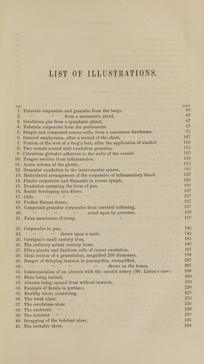 LIST OF ILLUSTRATIONS. FIG. PAQE 1. Tubercle corpuscles and granules from the lungs, . . . .66 2.   from a mesenteric gland, ... 67 3. Scrofulous pus from a lymphatic gland, ... .67 4. Tubercle corpuscles from the peritoneum, .... 67 5. Simple and compound cancer-cells, from a cancerous duodenum, . . 73 6. General emphysema, after a wound of the chest, . 107 7. Portion of the web of a frog's foot, after the application of alcohol, . 110 8. Two vessels coated with exudation granules, . ■ • ■ HI 9. Colourless globules adherent to the walls of the vessels. . '. . 115 10. Tongue swollen from inflammation. . • H£ 11. Acute oedema of the glottis, ..... . 119 12. Granular exudation in the intervascular spaces, . . . • 119 13. Reticulated arrangement of the corpuscles of inflammatory blood, . 127 14. Plastic corpuscles and filaments in recent lymph, . . • 136 15. Exudation assuming the form of pus, ...... 136 16. Nuclei developing into fibres, . . . ■ • 137 17. Cells  . . • • • .137 18. Perfect fibrous tissue, ....-■• 137 19. Compound granular corpuscles from cerebral softening, . . • 137 20.    acted upon by pressure, . . 138 21. False membrane of croup. . . .*•''. . 13!' 23. Corpuscles in pus, .... ... 142 24.   shown upon a scale, ..... 142 25. Corrigan's small cautery iron, ...... 181 26. The ordinary actual cautery irons, ...... 185 27. Fibro-plastic and fusiform cells of recent exudation, . . . 197 28. Ideal section of a granulation, magnified 200 diameters, . . .198 29. Danger of delaying incision in paronychia, exemplified, . . . 207 30. '•    shown on the bones, . • 207 31. Communication of an abscess with the carotid artery (Mr. Liston's case), 208 32. Bubo being incised, ........ 209 33. Abscess being opened from without inwards, .... 210 34. Example of fistula in perinseo, ... . 220 35. Healthy ulcer, cicatrizing, ... . 229 36. The weak ulcer, . . . - .233 37. The scrofulous ulcer, ...■•• 236 38. The cachectic  ... 238 39. The indolent ... 239 40. Strapping of the indolent ulcer, • 241 41. The irritable ulcer, ... 244