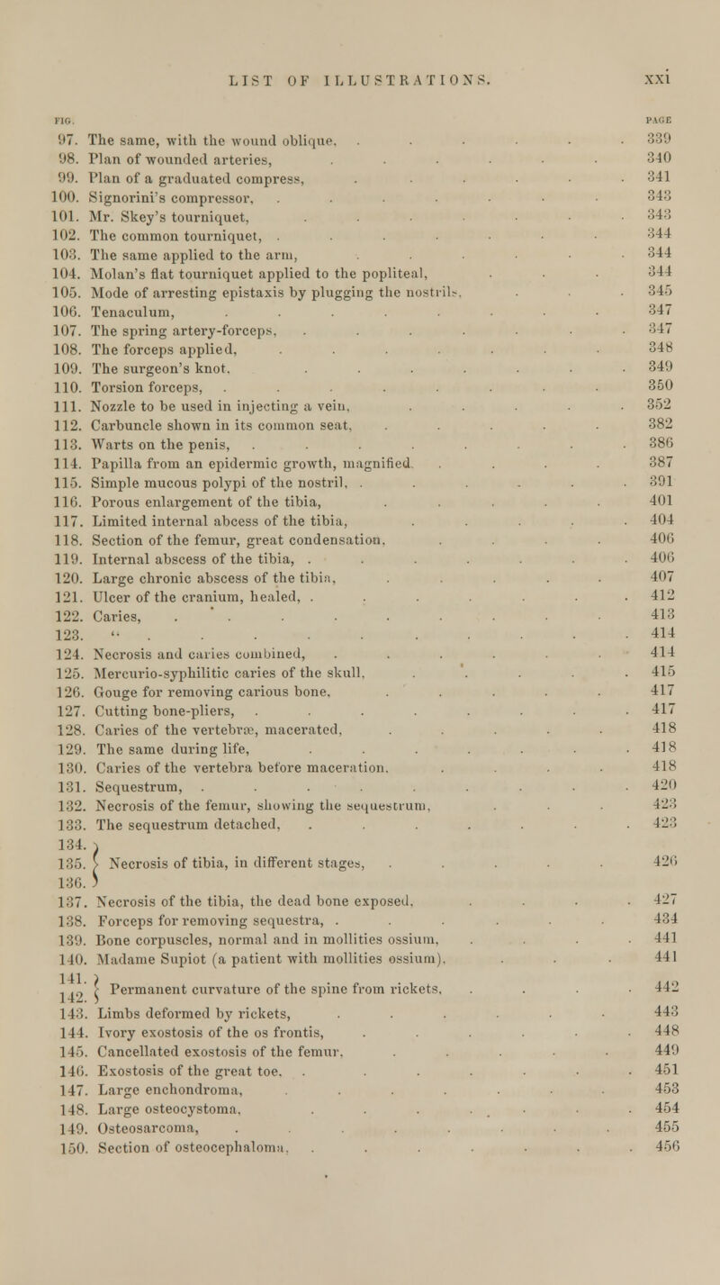 I i,. 97. 98. 99. 100. 101. 102. 103. 104. 105. 106. 107. 108. 109. 110. 111. 112. 113. 114. 115. 116. 117. 118. 119. 120. 121. 122. 123. L24. 125. 126. 127. 128. 129. 130. 131. 132. 133. 134. 135. 136. 137. 138. 139. 140. 141. 142. 143. 144. 1 15. 14<;. 147. 148. 149. 150. The same, with the wound oblique. Plan of wounded arteries, Plan of a graduated compress, Signorini's compressor, .... Mr. Skey's tourniquet, The common tourniquet, .... The same applied to the arm, Molan's flat tourniquet applied to the popliteal, Mode of arresting epistaxis by plugging the nostril Tenaculum, ..... The spring artery-forceps, The forceps applied, .... The surgeon's knot. Torsion forceps, ..... Nozzle to be used in injecting a vein. Carbuncle shown in its common seat, Warts on the penis, .... Papilla from an epidermic growth, magnified Simple mucous polypi of the nostril, . Porous enlargement of the tibia, Limited internal abcess of the tibia, Section of the femur, great condensation. Internal abscess of the tibia, . Large chronic abscess of the tibia, Ulcer of the cranium, healed, . Caries, ...... Necrosis and caries combined, Mercurio-syphilitic caries of the skull. Gouge for removing carious bone. Cutting bone-pliers, .... Caries of the vertebra, macerated, The same during life, Caries of the vertebra before maceration. Sequestrum, ..... Necrosis of the femur, showing the sequestrum, The sequestrum detached, > Necrosis of tibia, in different stages, Necrosis of the tibia, the dead bone exposed. Forceps for removing sequestra, . Bone corpuscles, normal and in mollities ossiuin, Madame Supiot (a patient with mollities ossium). ,- Permanent curvature of the spine from rickets, Limbs deformed by rickets, Ivory exostosis of the os frontis, Cancellated exostosis of the femur. Exostosis of the great toe. Large enchondroma, .... Large osteocystoma. Osteosarcoma, . . . . . Section of osteocephaloma, PAGE 339 340 341 34:; 343 344 344 344 345 347 347 348 349 350 352 382 386 387 391 401 404 406 406 407 412 413 414 414 415 417 417 418 418 418 420 423 423 420 427 434 441 441 442 443 448 449 451 453 454 455 450