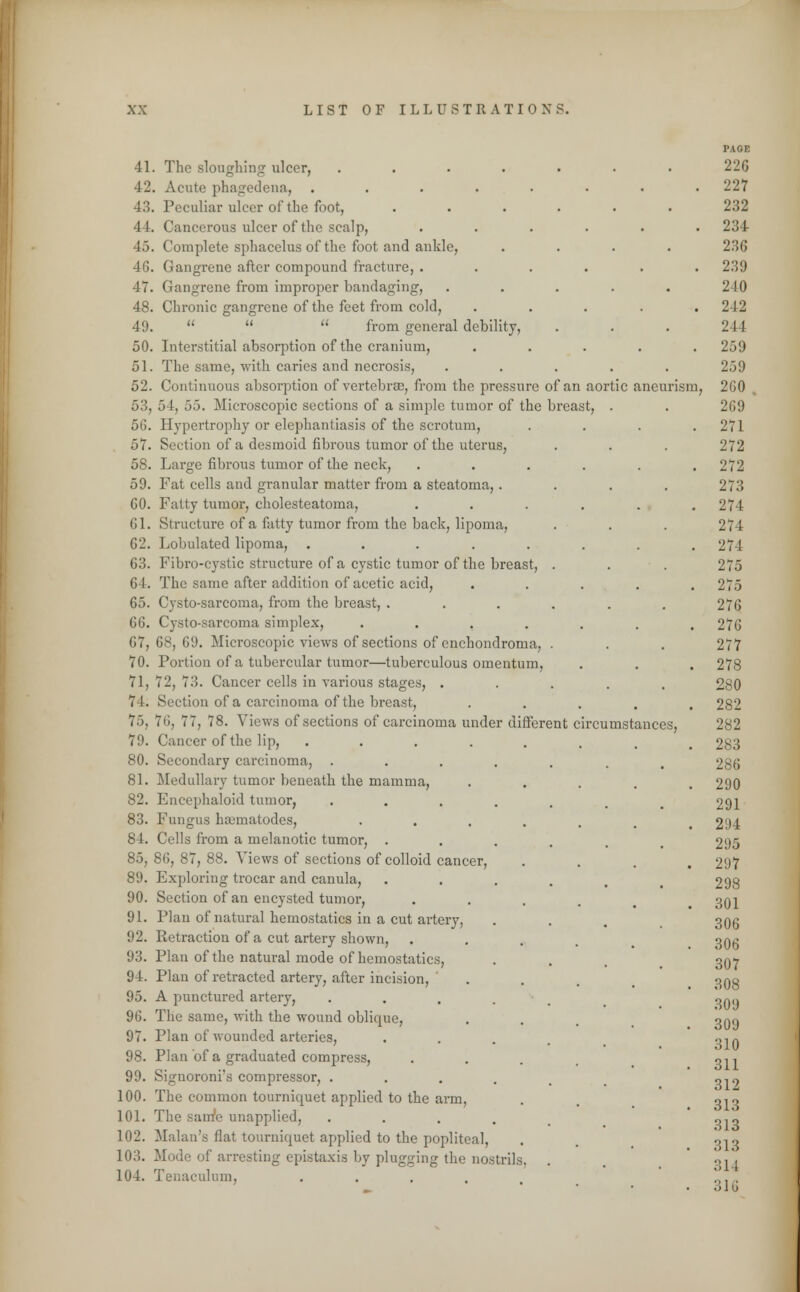 41. The sloughing ulcer, .... 42. Acute phagedena, .... 43. Peculiar ulcer of the foot, 44. Cancerous ulcer of the scalp, 45. Complete sphacelus of the foot and ankle, 46. Gangrene after compound fracture, . 47. Gangrene from improper bandaging, 48. Chronic gangrene of the feet from cold, 49.   u from general debility, 50. Interstitial absorption of the cranium, 51. The same, with caries and necrosis, 52. Continuous absorption of vertcbrse, from the pressure of an aortic aneurism 53. 54, 55. Microscopic sections of a simple tumor of the breast, . 5G. Hypertrophy or elephantiasis of the scrotum, 57. Section of a desmoid fibrous tumor of the uterus, 58. Large fibrous tumor of the neck, 59. Fat cells and granular matter from a steatoma,. GO. Fatty tumor, cholesteatoma, 61. Structure of a fatty tumor from the back, lipoma, 62. Lobulated lipoma, ..... 63. Fibro-cystic structure of a cystic tumor of the breast, 6 I. The same after addition of acetic acid, 65. Cysto-sarcoma, from the breast, . 66. Cysto-sarcoma simplex, .... 67. 68, 69. Microscopic views of sections of enchondroma, 70. Portion of a tubercular tumor—tuberculous omentum, 71, 72, 73. Cancer cells in various stages, . 7 I. Section of a carcinoma of the breast, 75, 76, 77, 78. Views of sections of carcinoma under different circumstances, 79. Cancer of the lip, .... 80. Secondary carcinoma, 81. Medullary tumor beneath the mamma, 82. Encephaloid tumor, 83. Fungus nematodes, 84. Cells from a melanotic tumor, . 85. 86, 87, 88. Views of sections of colloid cancer, 89. Exploring trocar and canula, 90. Section of an encysted tumor, 91. Plan of natural hemostatics in a cut artery, 92. Retraction of a cut artery shown, 93. Plan of the natural mode of hemostatics, 94. Plan of retracted artery, after incision, 95. A punctured artery, 96. The same, with the wound oblique, 97. Plan of wounded arteries, 98. Plan of a graduated compress, 99. Signoroni's compressor, . 100. The common tourniquet applied to the arm, 101. The saunfe unapplied, 102. Malan's flat tourniquet applied to the popliteal, 103. Mode of arresting epistaxia by plugging the nostrils. 104. Tenaculum, .....