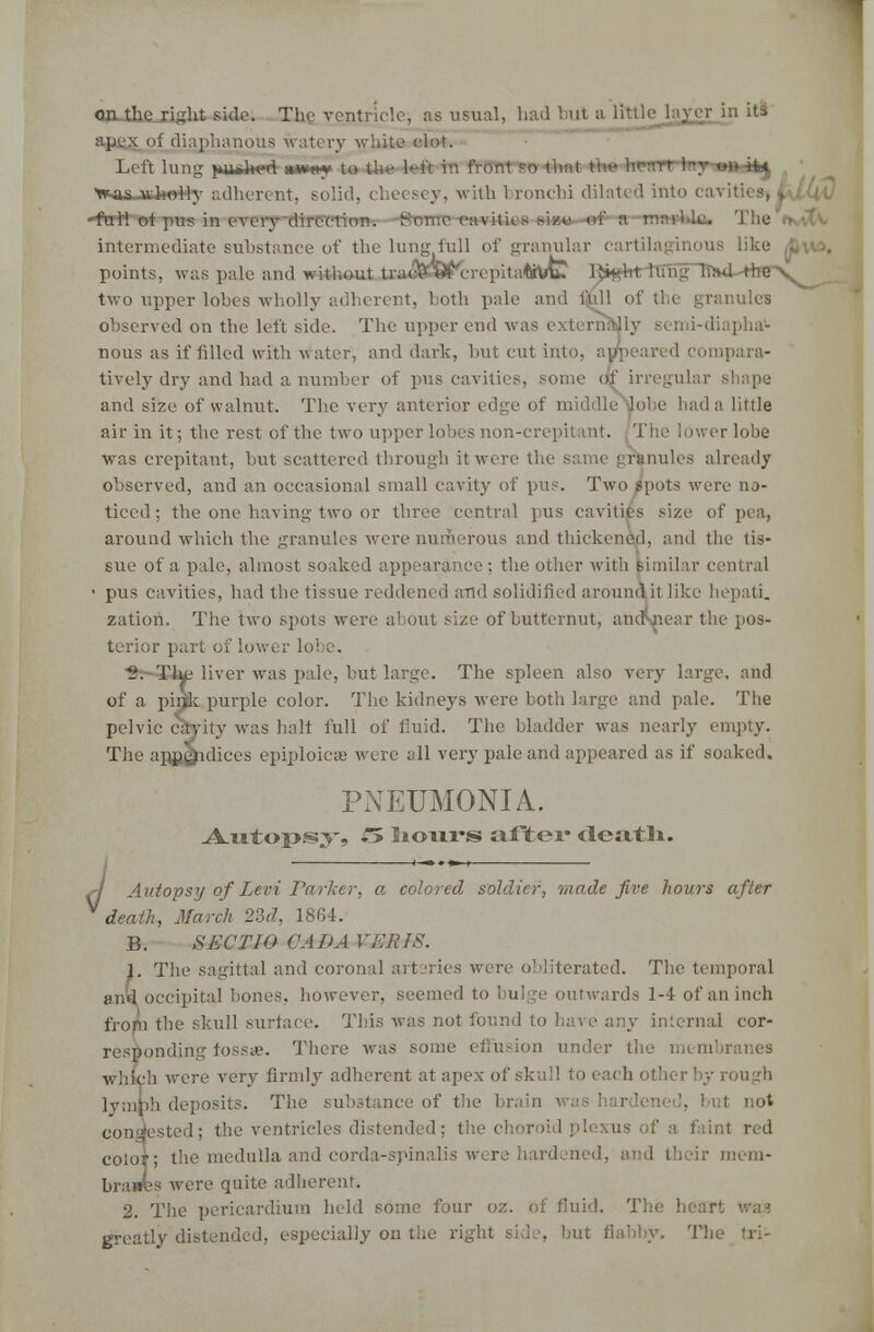 ClUhe right side. The ventricle, as usual, had but a Little Layer in its if diaphanous watery white clot. Left lung- }m*l*«d miw> to the left in front ?o thai the heart 'was.-nrlwMy adherent, solid, cheesey, with bronchi dilated into ca\ ftrtt of pus in every direction. Se.n-.e cavitii s size oi' The tvvtV intermediate substance of the lung lull of granular cartilaginous like /fivw. points, was pale and without fan rtrM^repitaOftfc l^ht rung mwU«be\. two upper lobes wholly adherent, both pale and i'nll of the granules observed on the left side. The upper end was externally semi-diapha- nous as if filled with water, and dark, but cut into, appeared compara- tively dry and had a number of pus cavities, some of irregular shape and size of walnut. The very anterior edge of middle lobe had a little air in it; the rest of the two upper lobes non-crepitant. The lower lobe was crepitant, but scattered through it were thi fynules already observed, and an occasional small cavity of pus. Two spots were no- ticed ; the one having two or three central pus cavities size of pea, around which the granules were numerous and thickened, and the tis- sue of a pale, almost soaked appearance ; the other with fcimilar central • pus cavities, had the tissue reddened and solidified around it like hepati. zation. The two spots were about size of butternut, andviear the pos- terior part of lower 1 i\ Tlye liver was pale, but large. The spleen also very large, and of a pinjk purple color. The kidneys were both large and pale. The pelvic cavity was halt full of fluid. The bladder was nearly empty. The appendices epiploicie were all very pale and appeared as if soaked. PNEUMONIA. Autopsy, £> liours aJfitei* cleatli. A Autopsy of Levi I'd rhtv. a colored soldier, made five hours after death, March 2M, 1864. B. SECT 10 ('ADA VMRfS. }. The sagittal and coronal arteries were obliterated. The temporal and occipital bones, however, seemed to I ul ■■■ outwards 1-4 of an inch from the skull surface. This was not found to have any internal cor- responding fossa1. There was some effusion under the mem which were very firmly adherent at apex of skull to each otl lymph deposits. The substance of the brain ■ id not congested; the ventricles distended; the choroid plexus of a faint red color; the medulla and corda-spinalis were hardened, mem- branes were quite adherent. 2. The pericardium held sonic four oz. of fluid. The heart greatly distended, especially on the right side, but flabby. T!,