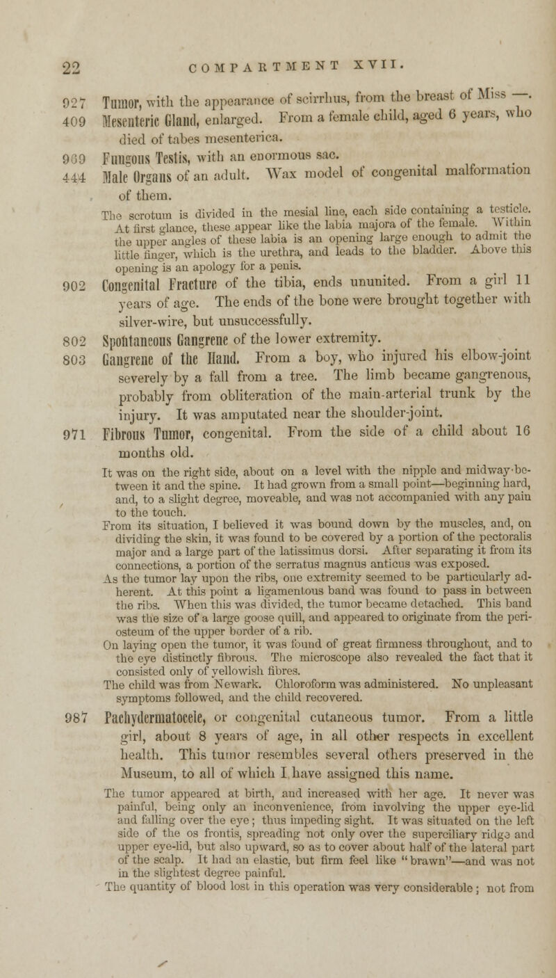 927 Tumor, wtth the appearance of soirrhus, from the breast of Miss —. 409 Mesenteric Glailll, enlarged. From a female child, aged 6 years, who died of tabes mesenteric*. 9G9 Fungous Teslis, with an enormous sac. 444 Male Organs of an adult. Wax model of congenital malformation of them. He scrotum is divided in the mesial line, each side containing a tesbj At first fiance, these appear like the labia majora of the female. AY ithin the upper angles of these labia is an opening largo enough to admit the little linger, which is the urethra, and leads to the bladder. Above tins opening is an apology lor a penis. 902 Congenital Fracture of the tibia, ends ununited. From a girl 11 years of age. The ends of the bone were brought together with silver-wire, but unsuccessfully. 802 Spontaneous Gangrene of the lower extremity. 803 Gangrene of the Hand. From a boy, who injured his elbow-joint severely by a fall from a tree. The limb became gangrenous, probably from obliteration of the main-arterial trunk by the injury. It was amputated near the shoulder-joint. 9*71 Fibrous Tumor, congenital. From the side of a child about 16 months old. It was on the right side, about on a level with the nipplo and midway-bo- tween it and the spine. It had grown from a small point—beginning hard, and, to a slight degree, moveable, and was not accompanied with any pain to the touch. From its situation, I believed it was bound down by the muscles, and, on dividing the skin, it was found to be covered by a portion of the pectoralis major and a large part of the latissimus dor.si. After separating it from its connections, a portion of the serratus magnus anticus was exposed. As the tumor lay upon the ribs, one extremity seemed to be particularly ad- herent. At this point a ligamentous band was tbund to pass in between the ribs. When this was divided, the tumor became detached. This band was the size of a large goose quill, and appeared to originate from the peri- osteum of the upper border of a rib. On laying open the tumor, it was found of great firmness throughout, and to the eye distinctly fibrous. Tho microscope also revealed the fact that it consisted only of yellowish fibres. The child was from Newark. Chloroform was administered. No unpleasant symptoms followed, and the child recovered. 987 Pachydermatocele, or congenital cutaneous tumor. From a little girl, about 8 years of age, in all other respects in excellent health. This tumor resembles several others preserved in the Museum, to all of which I have assigned this name. The tumor appeared at birth, and increased with her age. It never was painful, being only an inconvenience, from involving the upper eye-lid and falling over the eye ; thus impeding sight. It was situated on the left side of the os frontis, spreading not only over the superciliary ridga and r eye-lid, but also upward, so as to cover about half of the lateral part of the scalp. It had an elastic, but firm feel like brawn—and was not in the slightest degree painful. The quantity of blood lost in this operation was very considerable ; not from