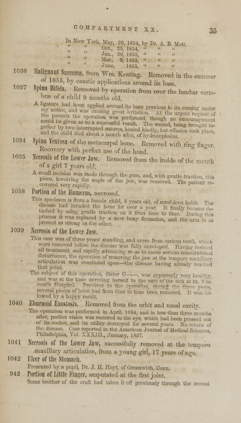 In New York, May, 26, 1854, by Dr. A. B. Mott Oct., 2.,, 1854,  Jan., 30, 1855,   « Mar., 9, 1855,   « June, 1855,   « 1036 Malignant Sarcoma, from Wm. Keating. Removed in the summer iao-t » ' 7 CaU8tic indications around its base. 1037 Spina Bifida. Remold by operation from over the lumbar v bra of a child 0 months old. A ^Zlr-V lT' aPI'liud ai'°Und itS base Previous t0 its comi^ under ii y not.c and was causing great irritation. At the argent reauest of the| parens the operation was performed, though no e°neotn , ■ could be gjven as to a successful result. The wound, being £S£fat tS g^bytw,mt--rruptedsutur,,, healed kindfctokffiE?g£ and t.ie child died about a month after, of hydrocephalus 1034 Spina Veillosa of the metacarpal bone. Removed with ring fino-er Recovery with perfect use of the hand 1035 talis Of the Lower JitW. Removed from the inside of the mouth of a girl 1 years old. A small incision was made through the gum, and, with gentle traction this S^SJS^.*6 of th0 jaw'was removei The patient ! 1038 Portion of the llunienis, necrosed. This ^edmenis from a female child, 8 years old, of scrofulous habit The disease had invaded the bone for over a year. It finally be :ame de- 1 gentle traction on it from time to time. Durinethis process it was replaced by a new bony formation, and the present as strong as the other. 1039 Necrosis of the Lower Jaw. This case was of three years' standing, and arose from carious teeth, were removed before the disease was fully developed. I ,1 all treatment, and rapidly advancing so as to cause serious con, disturbance, the of removing the jaw at the tempore - articulation was concluded upon—the disease having already n i d that point. J The subject of this operation, Sister G , was apparently very h a and was at the tune devoting herself to the care of the sick at tit Previous to t m, durin* the «■>»•<«> years i from time to time been removed. It wa lowed by esult. 1040 Ebumoid Exostosis. Removed from the orbit and nasal cavity. operation was performed in April. 1864, and in less than three months' r, perfect vision was restored to the eve, which had been pressed out of its BOCket, and its utility destroyed for several years. No return of ,,l(' diseasi ported in the American Journal of Medical Sciences, Philadelphia, Vol. XXXJIL, January, 1857. 1041 Necrosis of the Lower Jaw, successfully removed at the tempore maxillary articulation, from a voung girl, 17 years of age. 1042 Ulcer of the Stomach. Presented by a pupil, Pr. J. H. Iloyt, of Greenwich, Conn. 942 Portion Of Little Fillgcr, amputated at the first joint. Some brother of the craft had taken it off previously through the second