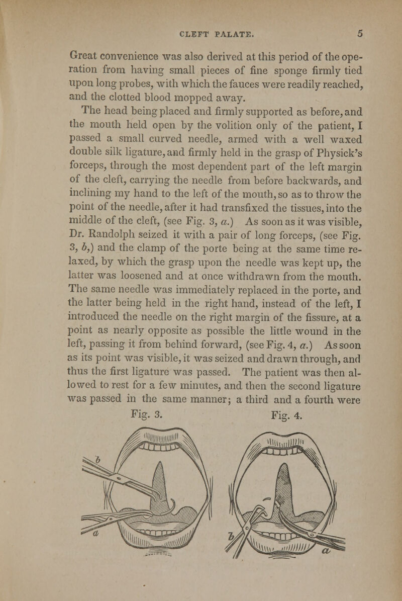 Great convenience was also derived at this period of the ope- ration from having small pieces of fine sponge firmly tied upon long probes, with which the fauces were readily reached, and the clotted blood mopped away. The head being placed and firmly supported as before, and the mouth held open by the volition only of the patient, I passed a small curved needle, armed with a well waxed double silk ligature, and firmly held in the grasp of Physick's forceps, through the most dependent part of the left margin of the cleft, carrying the needle from before backwards, and inclining my hand to the left of the mouth, so as to throw the point of the needle, after it had transfixed the tissues, into the middle of the cleft, (see Fig. 3, a.) As soon as it was visible, Dr. Randolph seized it with a pair of long forceps, (see Fig. 3, b,) and the clamp of the porte being at the same time re- laxed, by which the grasp upon the needle was kept up, the latter was loosened and at once withdrawn from the mouth. The same needle was immediately replaced in the porte, and the latter being held in the right hand, instead of the left, I introduced the needle on the right margin of the fissure, at a point as nearly opposite as possible the little wound in the left, passing it from behind forward, (see Fig. 4, a.) As soon as its point was visible, it was seized and drawn through, and thus the first ligature was passed. The patient was then al- lowed to rest for a few minutes, and then the second ligature was passed in the same manner; a third and a fourth were Fig. 3. Fig. 4.