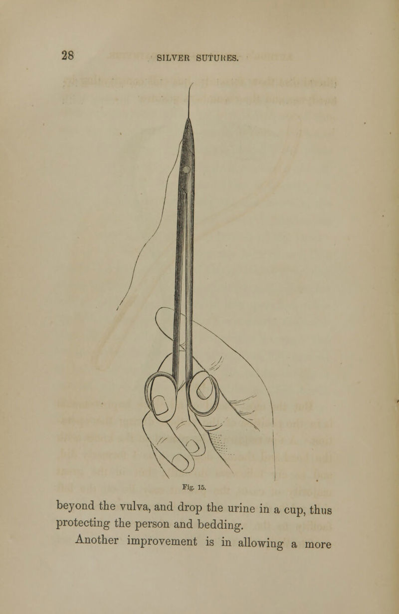 Fig. 15. beyond the vulva, and drop the urine in a cup, thus protecting the person and bedding. Another improvement is in allowing a more