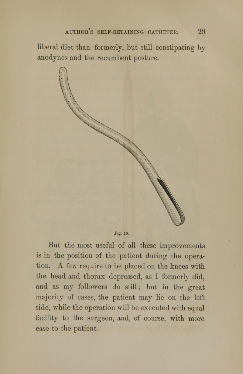 liberal diet than formerly, but still constipating by anodynes and the recumbent posture. Fig. 16. But the most useful of all these improvements is in the position of the patient during the opera- tion. A few require to be placed on the knees with the head and thorax depressed, as I formerly did, and as my followers do still; but in the great majority of cases, the patient may lie on the left side, while the operation will be executed with equal facility to the surgeon, and, of course, with more ease to the patient.