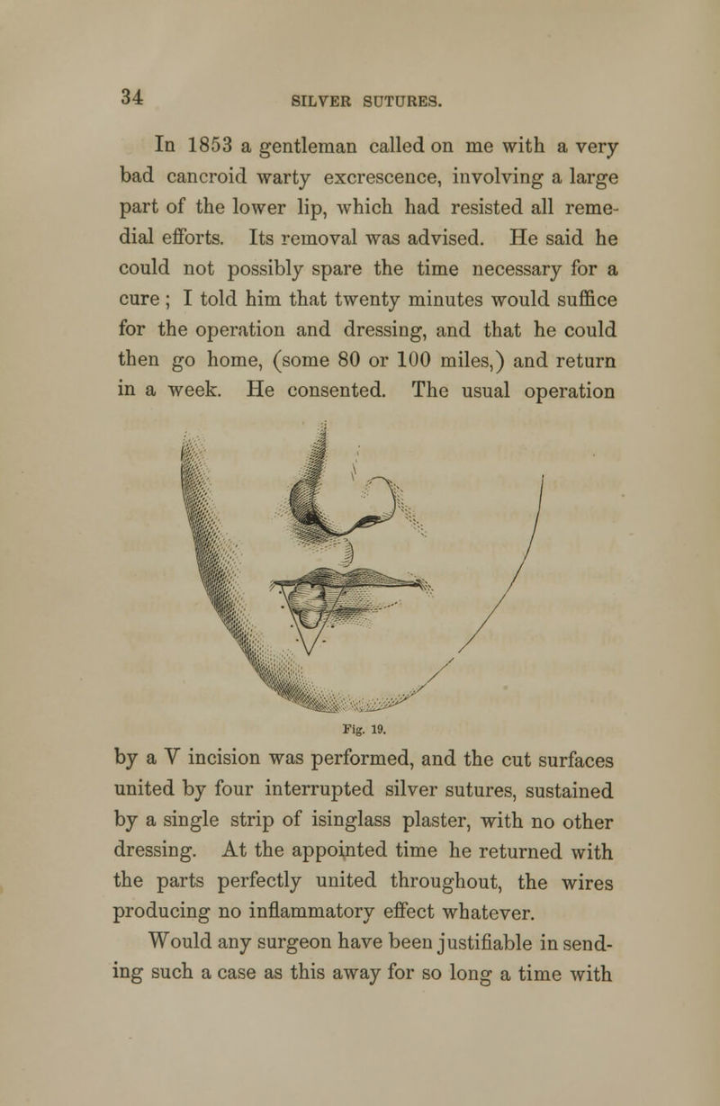 In 1853 a gentleman called on me with a very bad cancroid warty excrescence, involving a large part of the lower lip, which had resisted all reme- dial efforts. Its removal was advised. He said he could not possibly spare the time necessary for a cure ; I told him that twenty minutes would suffice for the operation and dressing, and that he could then go home, (some 80 or 100 miles,) and return in a week. He consented. The usual operation Fig. 19. by a V incision was performed, and the cut surfaces united by four interrupted silver sutures, sustained by a single strip of isinglass plaster, with no other dressing. At the appointed time he returned with the parts perfectly united throughout, the wires producing no inflammatory effect whatever. Would any surgeon have been justifiable in send- ing such a case as this away for so long a time with