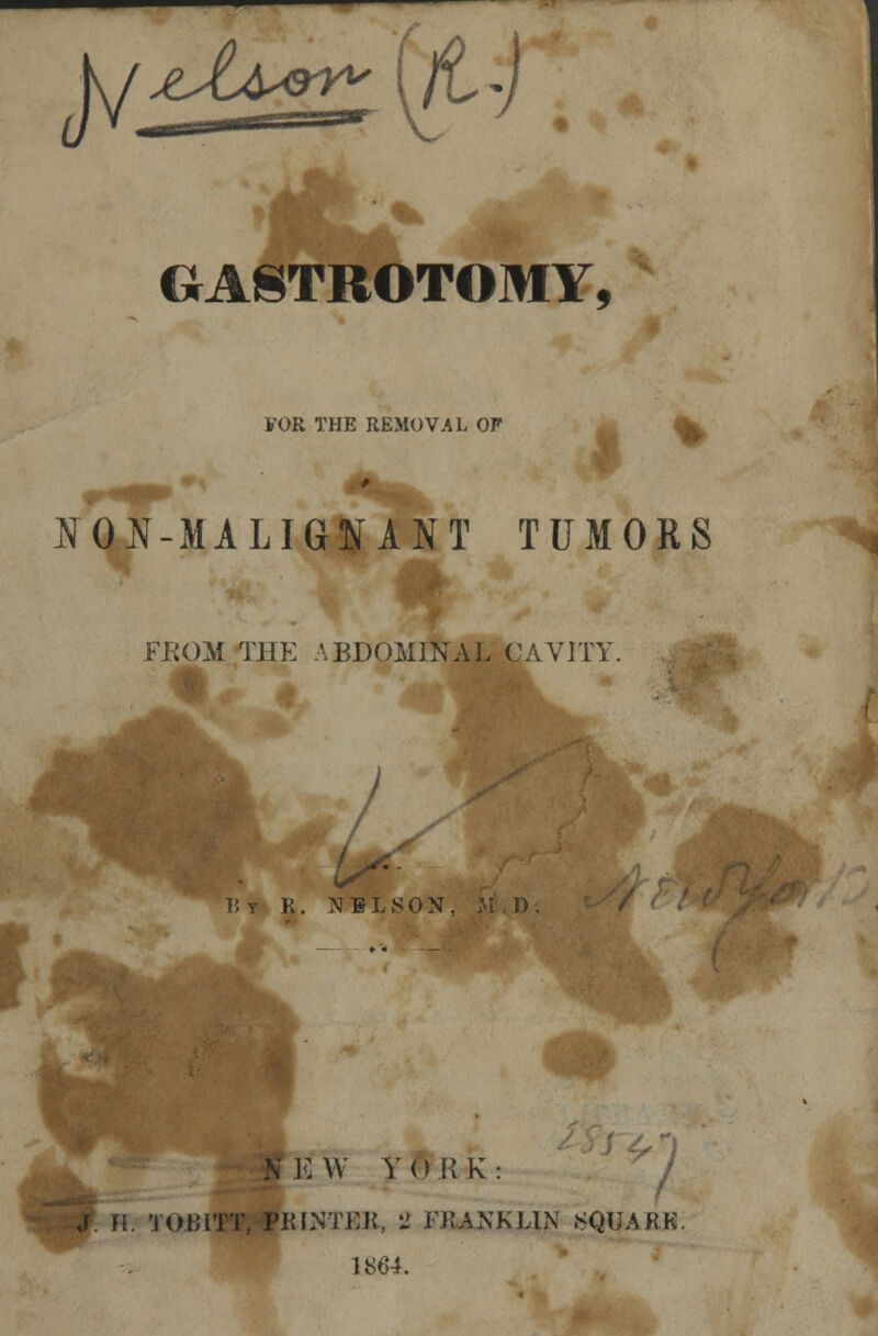 kj^tS^^ GASTROSTOMY, FOR THE REMOVAL OF NON-MALIGNANT TUMORS FROM THE ABDOMINAL CAVITY 1 lit K. NELSON, M.D. K W YORK: l&INTER, 2 FKANKLIN SQIJARK 1864.