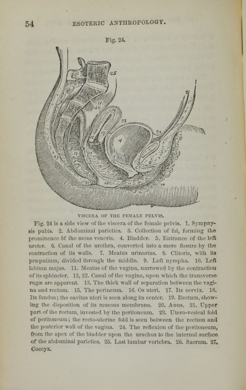 Fig. 24. V76CERA OF 'mi: FEMALE T>ELVI9. FSg. 24 is a side view of the viscera of the female pelvis. 1. Rympny- Bis pubis. 2. Abdominal parieties. 3. Collection of fat, forming the prominence of the oa veneris. 4. Bladder. 5. Entrance of tin' left ureter. 6. Canal of tbe urethra, converted into a mere fissure by the contraction of its walls. 7. Meatus urinarius. S. Clitoris, with its pra-putium, divided through the middle. 9. Left nynipha. I11- Left labium majus. 11. Meatus of the vagina, narrowed bj the contraction Of its sphincter. 12, 22. Canal of the vagina, upon which the transverse rugae are apparent. 13. The thick wall of separation between the vagi- na and rectum. 15. The perineum. 10. Os uteri. 17. Its cervix. IS. Its fundus; the cavitas uteri is seen along its center. 19. Rectum, show- ing the disposition of its mucous membrane. 20. Anus. 21. Upper part of the rectum, invested by the peritoneum. 23. Utero-vesical fold of peritoneum; the recto-uterine fold is seen between the rectum and the posterior wall of the vagina. 24. The reflexion of the peritoneum, from the apex of tie- bladder upon the urachus to the internal surface of the abdominal parieties. 25. Last lumbar vertebra. 2G. Sacrum. 2T. Coccyx.