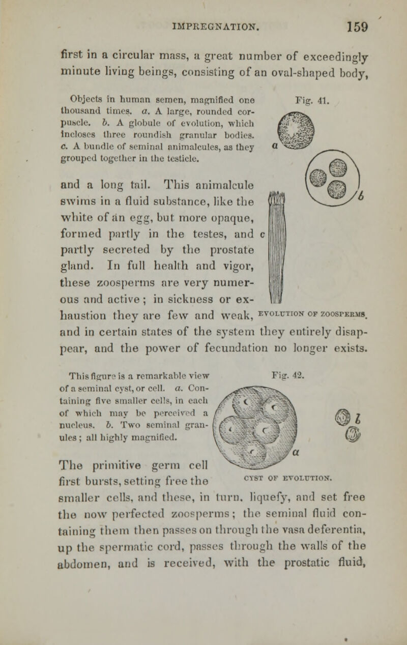 first in a circular mass, a great number of exceedingly minute living beings, consisting of an oval-shaped body, Objects in human semen, magnified one Fig. 41. thousand times, a. A large, rounded cor- puscle, b. A globule of evolution, which incloses three roundish granular bodies. c. A bundle of seminal animalcules, as they grouped together in the testicle. and a long tail. This animalcule swims in a fluid substance, like the white of an egg, but more opaque, formed partly in the testes, and c\ partly secreted by the prostate gland. In full health and vigor, these zoosperms are very numer- ous and active ; in sickness or ex- haustion they are few and weak, evolution of zoosperms. and in certain states of the system they entirely disap- pear, and the power of fecundation no longer exists. This figure is a remarkable view of a seminal cyst, or coll. a. Con- taining five smaller cells, in each of which may be perceived a nucleus, b. Two seminal gran- ules ; all highly magnified. The primitive germ cell first bursts, setting free the smaller cells, and these, in turn, liquefy, and set free the now perfected zoosperms; the seminal fluid con- taining them then passes on through t lie vasa deferentia, up the spermatic cord, passes through the walls of the abdomen, and is received, with the prostatic fluid, CIST OF EVOLUTION.