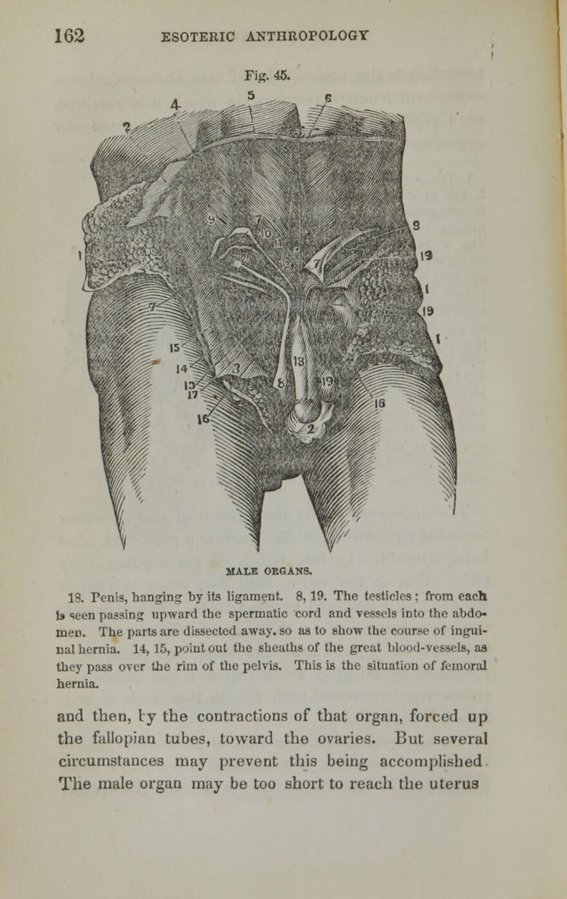 MALE OEGANS. IS. Penis, hanging by its ligament. 8,19. The testicles ; from each Is seen passing upward the spermatic cord and vessels into the abdo- men. The parts are dissected away, so as to show the course of ingui- nal hernia. 14,15, point out the sheaths of the great blood-vessels, as they pass over the rim of the pelvis. This is the situation of femoral hernia. and then, by the contractions of that organ, forced up the fallopian tubes, toward the ovaries. But several circumstances may prevent this being accomplished. The male organ may be too short to reach the uterus