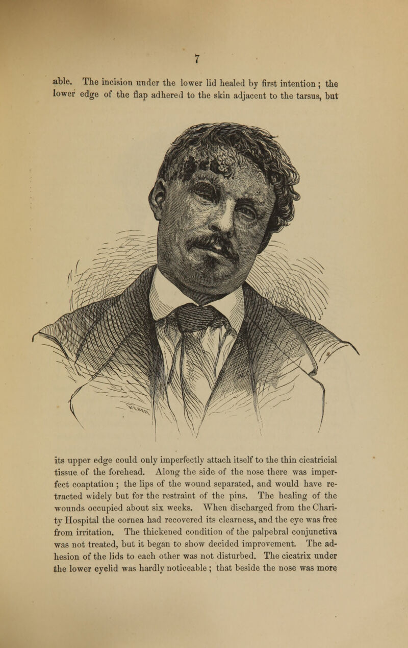 able. The incision under the lower lid healed by first intention ; the lower edge of the flap adhered to the skin adjacent to the tarsus, but its upper edge could only imperfectly attach itself to the thin cicatricial tissue of the forehead. Along the side of the nose there was imper- fect coaptation ; the lips of the wound separated, and would have re- tracted widely but for the restraint of the pins. The healing of the wounds occupied about six weeks. When discharged from the Chari- ty Hospital the cornea had recovered its clearness, and the eye was free from irritation. The thickened condition of the palpebral conjunctiva was not treated, but it began to show decided improvement. The ad- hesion of the lids to each other was not disturbed. The cicatrix under the lower eyelid was hardly noticeable ; that beside the nose was more