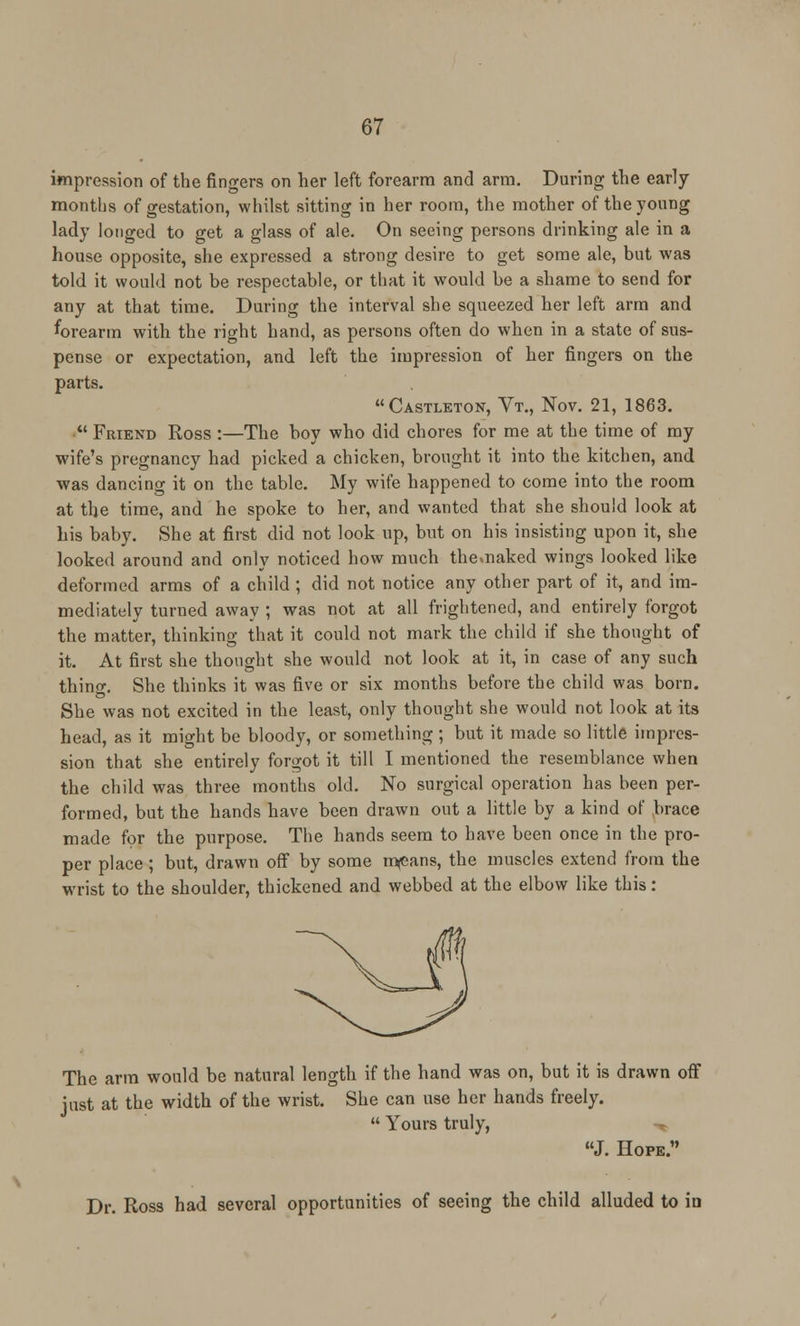 impression of the fingers on her left forearm and arm. During the early months of gestation, whilst sitting in her room, the mother of the young lady longed to get a glass of ale. On seeing persons drinking ale in a house opposite, she expressed a strong desire to get some ale, but was told it would not be respectable, or that it would be a shame to send for any at that time. During the interval she squeezed her left arm and forearm with the right hand, as persons often do when in a state of sus- pense or expectation, and left the impression of her fingers on the parts. Castleton, Vt., Nov. 21, 1863.  Friend Ross :—The boy who did chores for me at the time of my wife's pregnancy had picked a chicken, brought it into the kitchen, and was dancing it on the table. My wife happened to come into the room at the time, and he spoke to her, and wanted that she should look at his baby. She at first did not look up, but on his insisting upon it, she looked around and only noticed how much the%naked wings looked like deformed arms of a child ; did not notice any other part of it, and im- mediately turned away ; was not at all frightened, and entirely forgot the matter, thinking that it could not mark the child if she thought of it. At first she thought she would not look at it, in case of any such thing. She thinks it was five or six months before the child was born. She was not excited in the least, only thought she would not look at its head, as it might be bloody, or something ; but it made so little impres- sion that she entirely forgot it till I mentioned the resemblance when the child was three months old. No surgical operation has been per- formed, but the hands have been drawn out a little by a kind of brace made for the purpose. The hands seem to have been once in the pro- per place; but, drawn off by some mjeans, the muscles extend from the wrist to the shoulder, thickened and webbed at the elbow like this: The arm would be natural length if the hand was on, but it is drawn off just at the width of the wrist. She can use her hands freely.  Yours truly, J. Hope. Dr. Ross had several opportunities of seeing the child alluded to iu