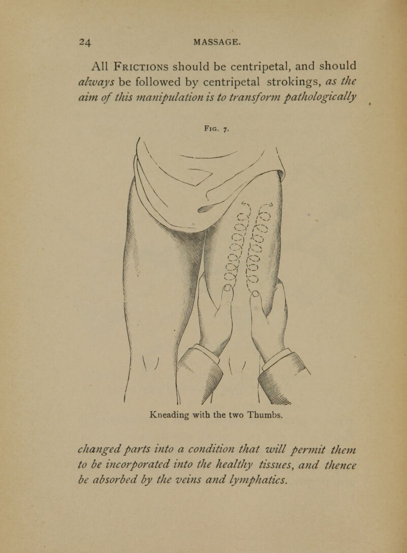 All Frictions should be centripetal, and should ahvays be followed by centripetal strokings, as the aim of this manipulation is to transform pathologically Fig. 7. Kneading with the two Thumbs. changed parts into a condition that will permit them to be incorporated into the healthy tissues, and thence be absorbed by the veins and lymphatics.