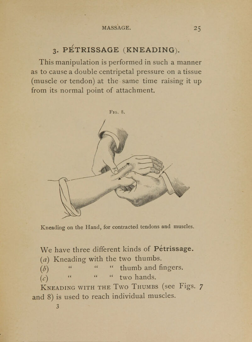 3. PETRISSAGE (KNEADING). This manipulation is performed in such a manner as to cause a double centripetal pressure on a tissue (muscle or tendon) at the same time raising it up from its normal point of attachment. Fig. 8. Kneading on the Hand, for contracted tendons and muscles. We have three different kinds of Petrissage. {a) Kneading with the two thumbs. ((^)    thumb and fingers. (^c)    two hands. Kneading with the Two Thumbs (see Figs. 7 and 8) is used to reach individual muscles. 3