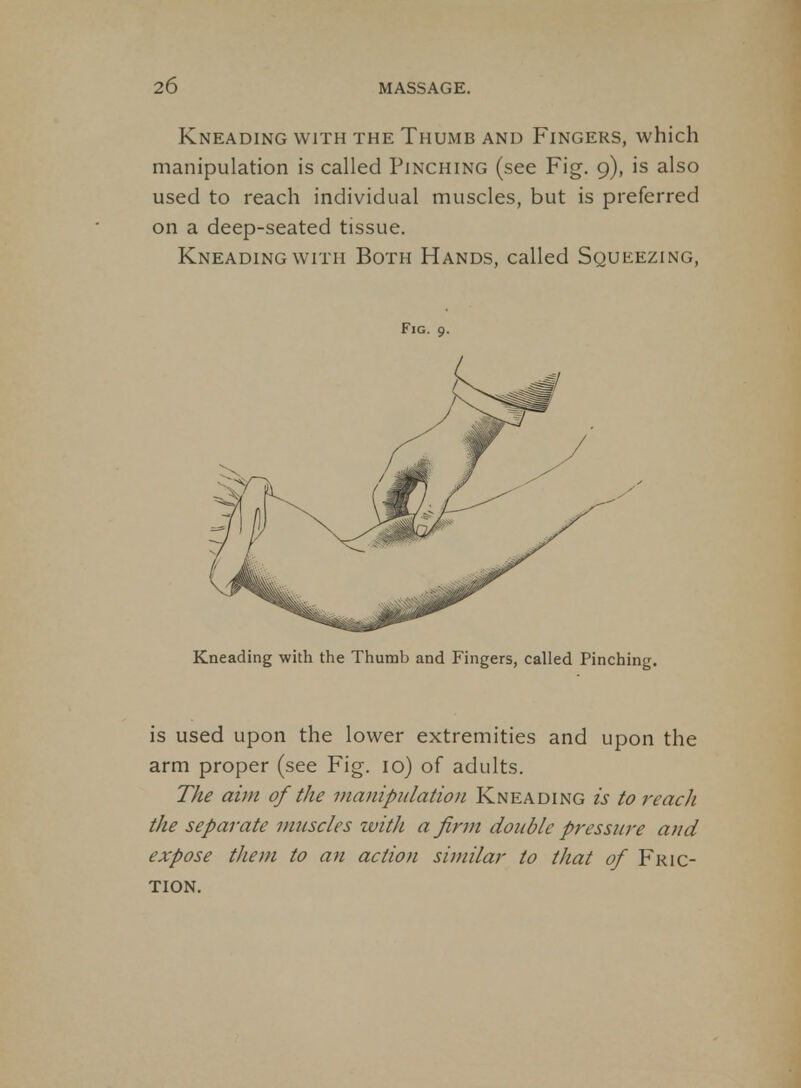 Kneading with the Thumb and Fingers, which manipulation is called Pinching (see Fig. 9), is also used to reach individual muscles, but is preferred on a deep-seated tissue. Kneading WITH Both Hands, called Squeezing, Fig. 9. Kneading with the Thumb and Fingers, called Pinching. is used upon the lower extremities and upon the arm proper (see Fig. 10) of adults. The aim of the manipulation Kneading is to reach the separate muscles with a firm double pressure and expose them to an action similar to that of Fric- tion.