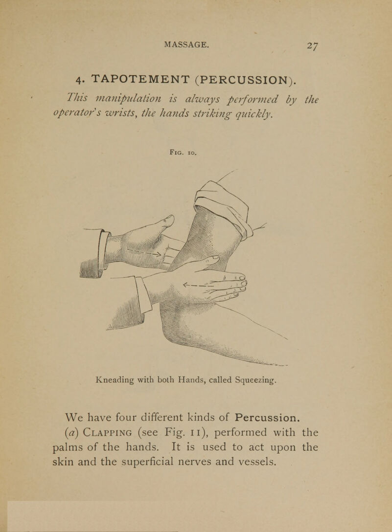 4. TAPOTEMENT (PERCUSSION). This manipnlaiion is ahvays performed by the operator s wrists, the hands striking quickly. Fig. 10. Kneading with both Hands, called Squeezing. We have four different kinds of Percussion. [ci) Clapping (see Fig. 11), performed with the palms of the hands. It is used to act upon the skin and the superficial nerves and vessels.
