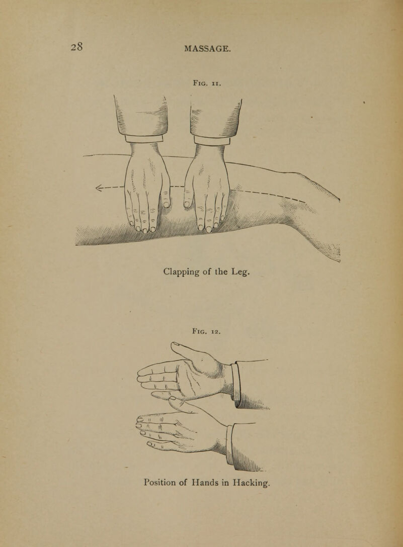 Fig. II. Clapping of the Leg. Fig. 12. Position of Hands in Hacking.