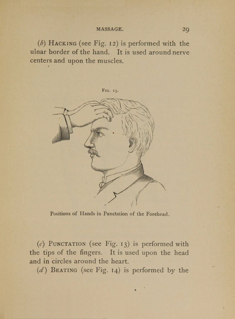 {b) Hacking (see Fig. 12) is performed with the ulnar border of the hand. It is used around nerve centers and upon the muscles. Fig. 13. Positions of Hands in Punctation of the Forehead. {c) Punctation (see Fig. 13) is performed with the tips of the fingers. It is used upon the head and in circles around the heart. {d) Beating (see Fig. 14) is performed by the