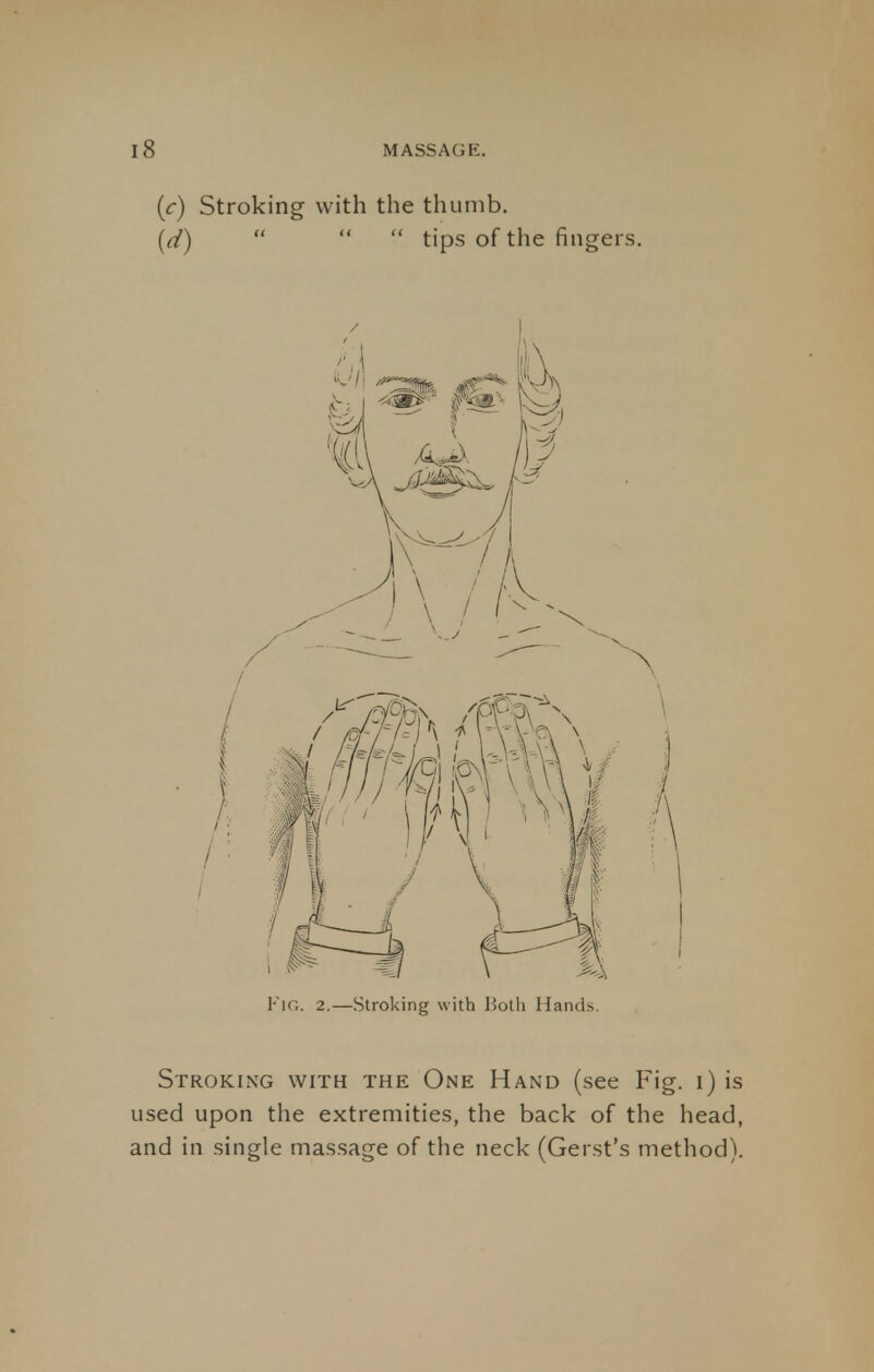 (c) Stroking with the thumb. (d)    tips of the ringers. FlG. 2.—Stroking with Both Hands. Stroking with the One Hand (see Fig. i) is used upon the extremities, the back of the head, and in single massage of the neck (Gerst's method).