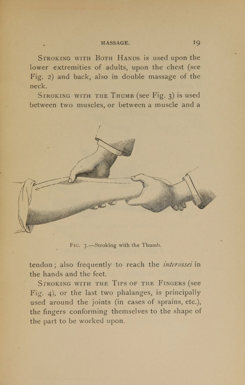 Stroking with Both Hands is used upon the lower extremities of adults, upon the chest (see Fig. 2) and back, also in double massage of the neck. Stroking with the Thumb (see Fig. 3) is used between two muscles, or between a muscle and a FlG. 3.—Stroking with the Thumb tendon ; also frequently to reach the interossei in the hands and the feet. Stroking with the Tips of the Fingers (see Fig. 4), or the last two phalanges, is principally- used around the joints (in cases of sprains, etc.), the fingers conforming themselves to the shape of the part to be worked upon.