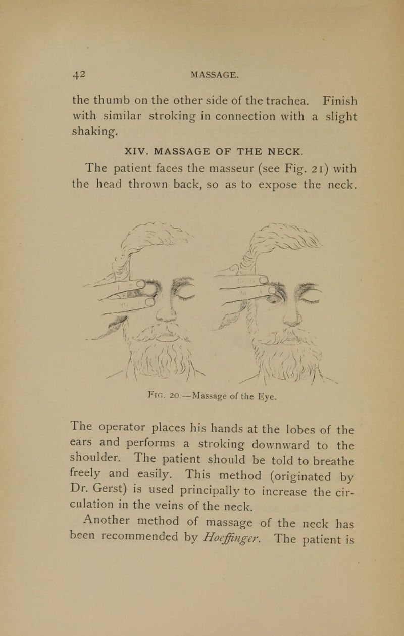 the thumb on the other side of the trachea. Finish with similar stroking in connection with a slight shaking. XIV. MASSAGE OF THE NECK. The patient faces the masseur (see Fig. 21) with the head thrown back, so as to expose the neck. Fie. 20 —Massage of the Eye. The operator places his hands at the lobes of the ears and performs a stroking downward to the shoulder. The patient should be told to breathe freely and easily. This method (originated by Dr. Gerst) is used principally to increase the cir- culation in the veins of the neck. Another method of massage of the neck has been recommended by Hoeffinger. The patient is