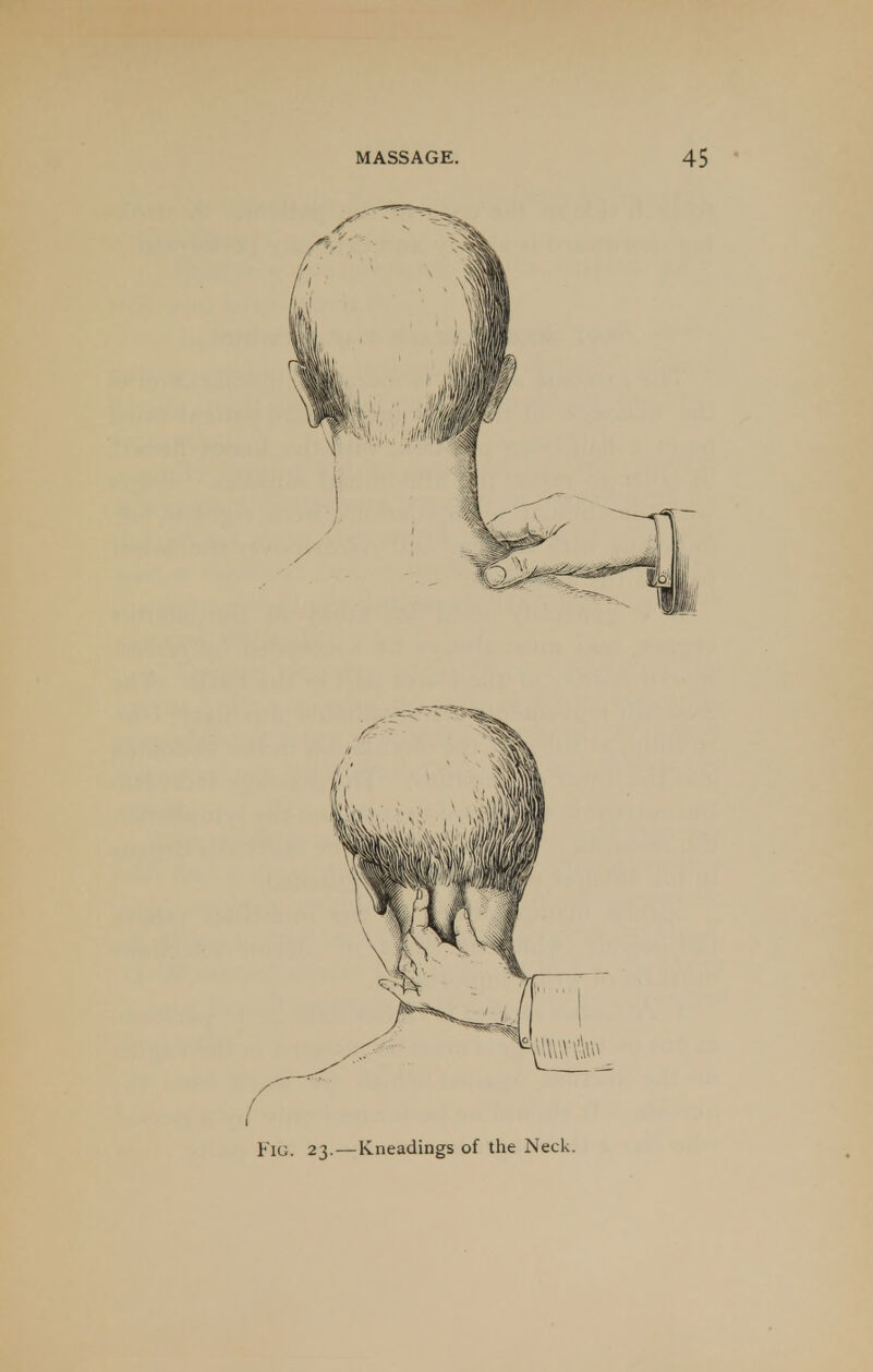 Fig. 23. — Kneadings of the Neck.