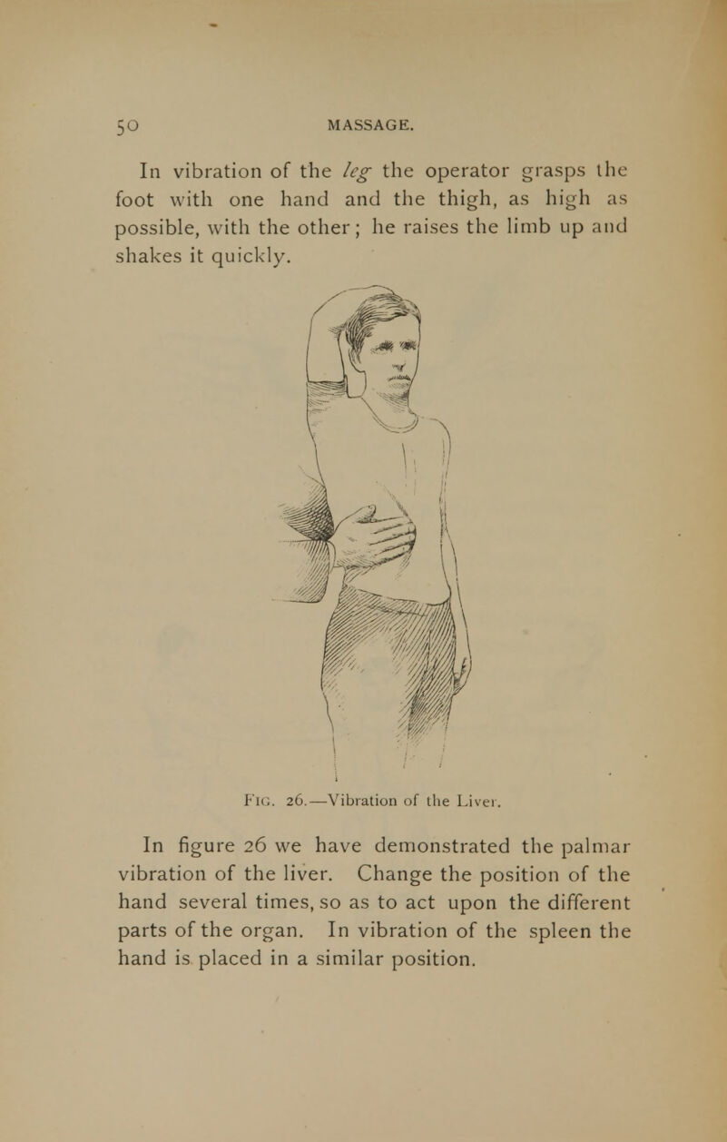 In vibration of the leg the operator grasps the foot with one hand and the thigh, as high as possible, with the other; he raises the limb up and shakes it quickly. Fig. 26.—Vibration of the Liver. In figure 26 we have demonstrated the palmar vibration of the liver. Change the position of the hand several times, so as to act upon the different parts of the organ. In vibration of the spleen the hand is placed in a similar position.