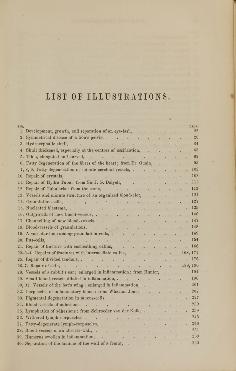 PIG. PAGE. 1. Development, growth, and separation of an eye-lash, ..... 22 2. Symmetrical disease of a lion's pelvis, 28 3. Hydrocephalic skull, 04 4. Skull thickened, especially at the centres of ossification, .... 65 5. Tibia, elongated and curved, . . . . . . . . . 6S 6. Fatty degeneration of the fibres of the heart; from Dr. Quain, ... 93 7,8,9. Fatty degeneration of minute cerebral vessels, 102 10. Repair of crystals, 108 11. Repair of Hydra Tuba: from Sir J. G. Dalyell, 112 12. Repair of Tubularia : from the same, 113 13. Vessels and minute structure of an organized blood-clot, . . . .121 14. Granulation-cells, ........... 127 15. Nucleated blastema, 129 16. Outgrowth of new blood-vessels, 146 17. Channelling of new blood-vessels, 147 18. Blood-vessels of granulations, ......... 148 19. A vascular loop among granulation-cells, ........ 149 20. Pus-cells, 154 21. Repair of fracture with ensheathing callus, ....... 166 22-3-4. Repairs of fractures with intermediate callus, 168,171 25. Repair of divided tendons, 176 26-7. Repair of skin, 189,190 28. Vessels of a rabbit's ear; enlarged in inflammation : from Hunter, . . . 194 29. Small blood-vessels dilated in inflammation, 196 30,31. Vessels of the bat's wing ; enlarged in inflammation, 201 32. Corpuscles of inflammatory blood: from Wharton Jones, .... 207 33. Pigmental degeneration in mucus-cells, . . . . . . • .227 34. Blood-vessels of adhesions, 239 35. Lymphatics of adhesions : from Schroeder van der Kolk, 239 36. Withered lymph-corpuscles, 245 37. Fatty-degenerate lymph-corpuscles, • 246 38. Blood-vessels of an abscess-wall, 231 39. Humerus swollen in inflammation, • 239 40. Separation of the laminae of the wall of a femur, 200