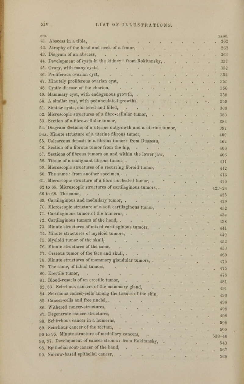 41. Abscess in a tibia, 42. Atrophy of the head and neck of a femur, 43. Diagram of an abscess, 44. Development of cysts in the kidney : from Rokitanskj' 45. Ovary, with many cysts, 46. Proliferous ovarian cyst, .... 47. Minutely proliferous ovarian cyst, 48. Cystic disease of the chorion, 49. Mammary cyst, with endogenous growth, . 50. A similar cyst, with pedunculated growths, . 51. Similar cysts, clustered and filled, 52. Microscopic structures of a fibro-cellular tumor, 53. Section of a fibro-cellular tumor, 54. Diagram sections of a uterine outgrowth and a uterine 54a. Minute structure of a uterine fibrous tumor, 55. Calcareous deposit in a fibrous tumor: from Dusseau 56. Section of a fibrous tumor from the hip, 57. Sections of fibrous tumors on and within the lower jaw 58. Tissue of a malignant fibrous tumor, . 59. Microscopic structures of a recurring fibroid tumor, 60. The same: from another specimen, . 61. Microscopic structure of a fibro-nucleated tumor, . 62 to 65. Microscopic structures of cartilaginous tumors, 66 to 68. The same, 69. Cartilaginous and medullary tumor, . TO. Microscopic structure of a soft cartilaginous tumor, 71. Cartilaginous tumor of the humerus, . . . • 72. Cartilaginous tumors of the hand, .... 73. Minute structures of mixed cartilaginous tumors, 74. Minute structures of myeloid tumors, 75. Myeloid tumor of the skull, .... 76. Minute structures of the same, .... 77. Osseous tumor of the face and skull, . 78. Minute structures of mammary glandular tumors, . 79. The same, of labial tumors, .... 80. Erectile tumor, 81. Blood-vesaels of an erectile tumor, 82. 83. Scirrhous cancers of the mammary gland, 84. Scirrhous cancer-cells among the tissues of the skin, 85. Cancer-cells and free nuclei, ..... 86. Withered cancer-structures, .... 87. Degenerate cancer-structures, .... 88. Schirrhous cancer in a humerus, 89. Scirrhous cancer of the rectum, .... 90 to 95. Minute structure of medullary cancers, 96,97. Development of cancer-stroma: from Rokitansky, 98. Epithelial soot-cancer of the hand, 99. Narrow-based epithelial cancer, .... tumor, PAGE. . 262 262 . 261 337 . 352 35 I . 355 356 . 359 359 . 360 383 . 384 397 . 400 402 . 406 400 . 411 412 . 410 420 423-24 425 . 429 432 . 434 438 . 441 440 . 452 453 . 460 470 . 475 478 . 481 491 . 496 496 . 498 498 . 508 509 538-40 543 . 567 568