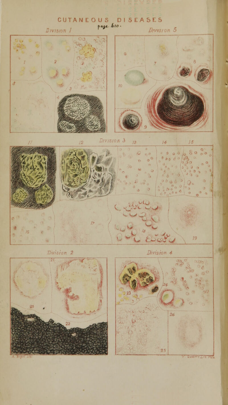 CUTANEOUS DISEASES Division I Division 5 MM ' Division 3 -4-*p' - Div/sio n 2 .21 Hk_ • i 22 -*t3K Division 4