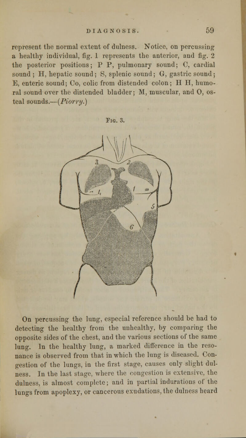 represent the normal extent of dulness. Notice, on percussing a healthy individual, fig. 1 represents the anterior, and fig. 2 the posterior positions; P P, pulmonary sound; C, cardial sound ; H, hepatic sound; S, splenic sound; G, gastric sound; E, enteric sound; Co, colic from distended colon; H H, humo- ral sound over the distended bladder; M, muscular, and 0, os- teal sounds.—{Piorry.) Fig. 3. On percussing the lung, especial reference should be had to detecting the healthy from the unhealthy, by comparing the opposite sides of the chest, and the various sections of the same lung. In the healthy lung, a marked difference in the reso- nance is observed from that in which the lung is diseased. Con- gestion of the lungs, in the first stage, causes only slight dul- ness. In the last stage, where the congestion is extensive, the dulness, is almost complete; and in partial indurations of the lungs from apoplexy, or cancerous exudations, the dulness heard