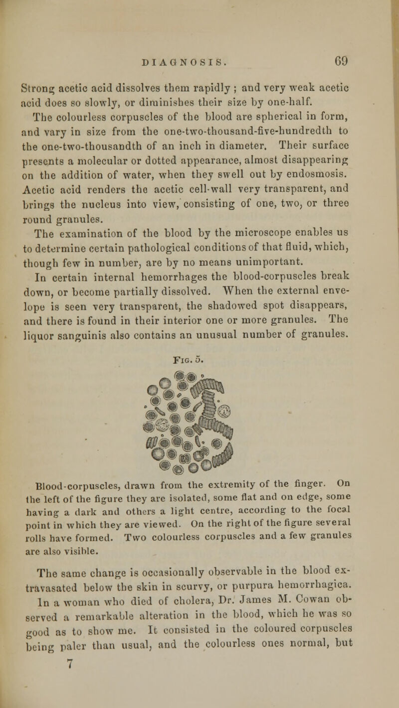 Strong acetic acid dissolves them rapidly ; and very weak acetic acid does so slowly, or diminishes their size by one-half. The colourless corpuscles of the blood are spherical in form, and vary in size from the one-two-thousand-five-hundredth to the one-two-thousandth of an inch in diameter. Their surface presents a molecular or dotted appearance, almost disappearing on the addition of water, when they swell out by endosmosis. Acetic acid renders tho acetic cell-wall very transparent, and brings the nucleus into view, consisting of one, two, or three round granules. The examination of the blood by the microscope enables us to determine certain pathological conditions of that fluid, which, though few in number, are by no means unimportant. In certain internal hemorrhages the blood-corpuscles break down, or become partially dissolved. When the external enve- lope is seen very transparent, the shadowed spot disappears, and there is found in their interior one or more granules. The liquor sanguinis also contains an unusual number of granules. Fig. o. Blood-corpuscles, drawn from the extremity of the finger. On the left of the figure they are isolated, some flat and on edge, some having a dark and others a light centre, according to the focal point in which they are viewed. On the right of the figure several rolls have formed. Two colourless corpuscles and a few granules are also visihle. The same change is occasionally observable in the blood ex- travasated below the skin in scurvy, or purpura hemorrhagica. In a woman who died of cholera, Dr. James M. Cowan ob- served a remarkable alteration in the blood, which he was so good as to show me. It consisted in the coloured corpuscles being paler than usual, and the colourless ones normal, but 7