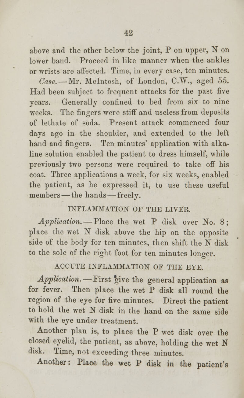 above and the other below the joint, P on upper, N on lower band. Proceed in like manner when the ankles or wrists are affected. Time, in every case, ten minutes. Case. — Mr. Mcintosh, of London, C.W., aged 55. Had been subject to frequent attacks for the past five years. Generally confined to bed from six to nine weeks. The fingers were stiff and useless from deposits of lethate of soda. Present attack commenced four days ago in the shoulder, and extended to the left hand and fingers. Ten minutes' application with alka- line solution enabled the patient to dress himself, while previously two persons were required to take off his coat. Three applications a week, for six weeks, enabled the patient, as he expressed it, to use these useful members — the hands — freely. INFLAMMATION OF THE LIVER. Application. — Place the wet P disk over No. 8; place the wet N disk above the hip on the opposite side of the body for ten minutes, then shift the N disk to the sole of the right foot for ten minutes longer. ACCUTE INFLAMMATION OF THE EYE. Application.—First give the general application as for fever. Then place the wet P disk all round the region of the eye for five minutes. Direct the patient to hold the wet N disk in the hand on the same side with the eye under treatment. Another plan is, to place the P wet disk over the closed eyelid, the patient, as above, holding the wet N disk. Time, not exceeding three minutes. Another: Place the wet P disk in the patient's