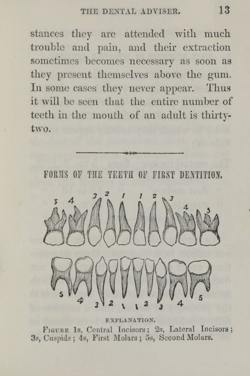 stances they arc attended with much trouble and pain, and their extraction sometimes becomes necessary as soon as they present themselves above the gum. In some cases they never appear. Thus it will be seen that the entire number of teeth in the mouth of an adult is thirty- two. FORMS OF THE TEETH OF FIRST DENTITION. 3, 2 i 12 EXPLANATION. Figure Is, Central Incisors; 2s, Lateral Incisors; 3-s Cuspids ; 4s, First Molars ; 5s, Second Molars.