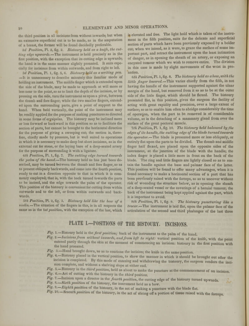 10 ELEMENTARY AND MINOR OPERATIONS. the third position in all incisions from without inwards; but when an extensive superficial cut is to be made, as in the amputation of a breast, the former will be found decidedly preferable. Position, PI. 2, fig. 2. Bistoury held as a knife, the cut- edge upwards.—The instrument is held precisely as in the fust position, with the exception that its cutting edge is upwards; the hand is in the same manner slightly pronated. It suits espe- cially for incisions from within outwards, and from right to left. 3d Position, PI. 1, fig. 5, 6. Bistoury held as a ivriting pen. —It is unnecessary to describe minutely this familiar mode of holding an instrument. The middle finger which is extended upon the side of the blade, may be made to approach at will more or less near to the point, so as to limit the depth of the incision, or by pressing on the side, turn the instrument as upon a pivot, between the thumb and fore finger; while the two smaller fingers, extend- ed upon the surrounding parts, give a point of support to the hand. When held vertically, the point of the instrument may be readily applied for the purpose of making punctures as directed in some forms of erysipelas. The bistoury may be inclined more or less forward or backward in this position so as to facilitate the section of parts, but cannot be brought to the horizontal direction for the purpose of giving a sweeping cut; the section is, there- fore, chiefly made by pressure, but is well suited to operations in which it is necessary to make deep but short incisions, as in the external cut for stone, or the laying bare of a deep-seated artery for the purpose of surrounding it with a ligature. 4th Position, PI. 1, fig. 7. The cutting edge turned toivards the palm of the hand.—The bistoury held as has just been de- scribed, may be turned between the thumb and fore finger, so as to present obliquely backwards, and come into the fourth position, ready to cut in a direction opposite to that in which it is com- monly employed; that is, with the back turned towards the parts to be incised, and the edge towards the palm of the operator. This position of the bistoury is convenient for cutting from within outwards and to the left, or from within outwards and back- wards. 5th Position, PI. 2, fig. 3. Bistoury held like the bow of a violin.—The situation of the fingers in this, is in all respects the same as in the 1st positioti, with the exception of the last, which is elevated and free. The light hold which is taken of the instru- ment in the fifth position, suits for the delicate and superficial section of parts which have been previously exposed by a bolder cut; when we intend, as it were, to graze the surface of some im- portant part, and retract the instrument upon the least intimation of danger, as in opening the sheath of an artery, or exposing an encysted tumour which we wish to remove entire. The division in this case is made by slight movements of the wrist in pro- nation. 6th Position, PI. 1, fig. 8. The bistoury held as a bow, with the little finger lowered.—This varies chiefly from the fifth, in not having the handle of the instrument supported against the ulnar margin of the hand, but removed from it so as to be at the outer side of the little finger, which should be flexed. The bistoury presented flat, in this position, gives the surgeon the facility of acting with great rapidity and precision, over a large extent of surface; so as to enable him often to abridge considerably the time of operation, when the part to be removed is of considerable volume, as in the detaching of a mammary gland from over the surface of the great pectoral muscle. 1th Position, PI. 1, fig. 10. The bistoury held balanced by the edges of its handle, the cutting edge of the blade turned towards the operator.—The blade is presented more or less obliquely, or entirely flat upon the parts to be divided. The thumb and middle finger half flexed, are placed upon the opposite sides of the instrument, at the junction of the blade with the handle; the index finger is placed a little more in front on the back of the blade. The ring and little fingers are lightly closed so as to sus- tain the handle against the base and palmar face of the latter. This position will be found to offer many advantages, when it is found necessary to make a horizontal section of a part that has been previously raised with the forceps, so as to uncover without risk of wounding the structure below, as in opening the sheath of a deep-seated vessel or the coverings of a hernial tumour; the back of the instrument being kept applied against the part, which it is important to avoid. 8th Position, PI. ], fig. 9. The bistoury puncturing like a trocar.—The instrument is laid flat, upon the palmar face of the articulation of the second and third phalanges of the last three PLATE L—POSITIONS OF THE BISTOURY. INCISIONS. Fig Fig Fit FU Fig Fig Fig, Fig, Fig, Fig . 1.—Bistoury held in the first position; back of the instrument to the palm of the hand. 2.—Incisions from ivithout inivards, and from left to right: vertical position of the knife, with the point entered partly through the skin at the moment of commencing an incision: bistoury in the first position with the hand pronated. . 3.—Hand brought down, so as to continue the incision; the knife in the same position. .4.—Bistoury placed in the vertical position, to show the manner in which it should be brought out after the incision is completed. By this mode of entering and withdrawing the bistoury, the surgeon renders the inci- sion complete, and without a shelving slope at either end. 5.—Bistoury in the third position, held as about to make the puncture at the commencement of an incision . 6.—Act of cutting with the bistoury in the third position. 7.—Incision upon a director in the fourth position, the cutting edge of the bistoury turned upwards 8.—Sixth position of the bistoury, the instrument held as a bow. 9.—Eighth position of the bistoury, in the act of making a puncture with the blade flat. 10.—Seventh position of the bistoury, in the act of slicing off a portion of tissue raised with the forceps.
