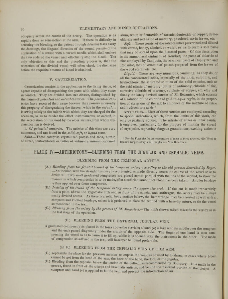 obliquely across the course of the artery. The operation is as rapidly done as venesection at the arm. If there is difficulty in arresting the bleeding, or the patient through delirium tears away the dressings, the diagonal direction of the wound permits of the application of a suture with a curved needle which shall enclose the two ends of the vessel and effectually stop the blood. The only objection to this and the preceding process is, that the retraction of the divided vessel will often check the discharge before the requisite amount of blood is obtained. V. CAUTERIZATION. Cauterization consists in the application to the living tissue, of agents capable of disorganizing the parts with which they come in contact. They are divided into two classes, distinguished by the names of potential and actual cauteries. The potential cau- teries have received their name because they possess inherently this property of disorganizing the tissues; while in the actual, it is owing solely to the caloric with which they are charged for the occasion, so as to render the effect instantaneous, or actual, in the acceptation of this word by the older writers, from whom this classification is derived. 1. Of potential cauteries. The articles of this class are very numerous, and are found in the solid, soft, or liquid state. Solid.—These comprise crystallized potash and soda, nitrate of silver, deuto-chloride or butter of antimony, minium, calcined alum, white or deutoxide of arsenic, deutoxide of copper, deuto- chloride and red oxide of mercury, powdered savin leaves, etc. Soft.—These consist of the solid caustics pulverized and diluted with cerate, honey, alcohol, or water, so as to form a soft paste that may be spread upon the diseased parts. Of this description is the ammoniacal ointment of Gondret; the paste of chloride of zinc employed by Canquoin, the arsenical paste of Dupuytren and Roussilot, that of oxalate of potash prepared from the leaves of the wood sorrel, etc. etc. Liquid.—These are very numerous, consisting, as they do, of all the concentrated acids, especially of the nitric, sulphuric, and hydrochloric; the saturated solution of the solid caustics, such as the acid nitrate of mercury, butter of antimony, chloride of zinc, corrosive chloride of mercury, sulphate of copper, etc. etc.; and finally the lately devised caustic of M. Recamier, which consists of a solution of the chloride of gold in aqua regia, in the propor- tion of six grains of the salt to an ounce of the mixture of nitric and hydrochloric acids.* Application.—Most of these caustics are employed according to special indications, which, from the limits of this work, can only be partially noticed. The nitrate of silver or lunar caustic is employed particularly for the purpose of limiting the spread of erysipelas, repressing fungous granulations, exciting action in * For the Formulae for the preparation of most of these articles, vide Wood & Bache's Dispensatory, and Dunglison's New Remedies. PLATE IV.-ARTERIOTOMY-BLEEDING FROM THE JUGULAR AND CEPHALIC VEINS. BLEEDING FROM THE TEMPORAL ARTERY. (A.) Bleeding from the frontal branch of the temporal artery according to the old process described by Boyer. —An incision with the straight bistoury is represented as made directly across the course of the vessel so as to divide it. Two small graduated compresses are placed across parallel with the lips of the wound, to show the manner in which compression is to be made, after a sufficient amount of blood has been taken. A roller bandage is then applied over these compresses. (B.) Incision of the trunk of the temporal artery above the zygomatic arch.—It the cut is made transversely from a point above the zygomatic arch and in front of the concha and antitragus, the artery may be always neatly divided across. As there is a solid bony surface below, the hemorrhage may be arrested at will with a compress and knotted bandage, unless it is preferred to close the wound with a hare-lip suture, or tie the vessel as mentioned in the text. (C.) Bleeding from the artery by the process of M. Magistrel.-The knife shown raised towards the vertex as in the last stage of the operation. (D.) BLEEDING FROM THE EXTERNAL JUGULAR VEIN. A graduated compress (a) is placed in the fossa above the clavicle; a band (ft) is laid with its middle over the compress and the ends passed diagonally under the armpit of the opposite side. The finger of one hand is seen com- pressing the vessel so as to cause it to fill up, while it is opened with the instrument in the other. The mode of compression as advised in the text, will however be found preferable. (E. F.) BLEEDING FROM THE CEPHALIC VEIN OF THE ARM. (E-) ^^^T^AV7TB incisrt0 expose the vein'as advised by Lisfranc>in cases where blood °™not be fot froni the bend of the arm, the back of the hand, the foot, or the jugular. (K) Bleeding from the cephalic below the tendon of the deltoid, as recommended by Bourgery. It is made in the groove, found in front of the triceps and brachialis amicus, and behind the external portion of the bicen* A compress and band (c) is applied to fill the vein and prevent the introduction of air. l '