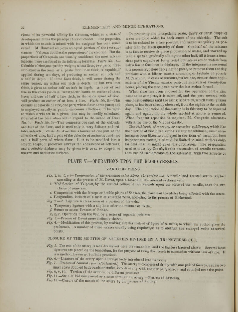 virtue of its powerful affinity for albumen, which in a state of development forms the principal bulk of cancer. The proportion in which the caustic is mixed with its excipient has been much varied. M. Bureaud employs an equal portion of the two sub- stances. Velpeau doubles the proportion of the chloride. But the proportions of Canquoin arc usually considered the most advan- tageous; these are found in the following formulas. Paste No. 1:— Chloride of zinc, one part by weight; wheat flour, two parts. This employed in the form of a paste four lines thick, is capable, if applied during ten days, of producing an eschar an inch and a half in depth. If three lines thick, it will cause during the same period, an eschar one inch in depth. If but two lines thick, it gives an eschar half an inch in depth. A layer of one line in thickness yields in twenty-four hours, an eschar of three lines; and one of half a line thick, in the same space of time, will produce an eschar of at least a line. Paste No. 2:—This consists of chloride of zinc, one part; wheat flour, three parts; and is employed usually in painful cancerous affections. The depth to which it will act in a given time may be readily calculated, from what has been observed in regard to the action of Paste No. 1. Paste No. 3:—This comprises one part of the chloride, and four of the flour; and is used only in very delicate and irri- table subjects. Paste No. 4:—This is formed of one part of the chloride of zinc, half a part of the chloride of antimony, and two and a half parts of wheat flour. It is to be moulded into a crayon shape; it preserves always the consistence of soft wax, and a suitable thickness may be given to it so as to adapt it to uneven and nodulated surfaces. In preparing the phagedenic paste, thirty or forty drops of water are to be added for each ounce of the chloride. The salt is to be reduced to a fine powder, and mixed as quickly as pos- sible with the given quantity of flour. One half of the mixture is at first to receive its given proportion of water, and worked up with a spatula, gradually adding the other half, till it forms a tena- cious paste capable of being rolled out into cakes or wafers from half a line to four lines in thickness. If the integuments are sound it is necessary, before applying the paste, to remove them the day previous with a blister, caustic ammonia, or hydrate of potash- M. Canquoin, in cases of tumours, makes one, two, or three appli- cations of the Vienna caustic paste, at intervals of twenty-four hours, placing the zinc paste over the last eschar formed. When time has been allowed for the operation of the zinc paste to be complete, it is taken off, and the part covered with emollient poultices until the eschar separates, which usually takes place, as has been already observed, from the eighth to the twelfth day. The application of the caustic is in this way to be repeated again and again, till the whole morbid structure is removed. When frequent repetition is required, M. Canquoin alternates with it the use of the Vienna caustic. The bichloride of mercury or corrosive sublimate, which like the chloride of zinc has a strong affinity for albumen, has in some instances been likewise employed in the form of paste, but from its poisonous nature, it should be limited to small surfaces only, for fear that it might enter the circulation. The preparation used at times by Graefe, for the destruction of erectile tumours, consisted of two drachms of the sublimate, with two scruples of PLATE V.-OPERATIONS UPON THE BLOOD-VESSELS. VARICOSE VEINS. Fi, 1. (a, b,c.) — Compression of the principal veins above the varices.—a, A needle and twisted suture applied according to the process of M. Davat, upon a branch of the internal saphena vein. b. Modification of Velpeau, by the vertical rolling of two threads upon the sides of the needle, next the two places of puncture. c. Compression with the forceps or double plates of Sanson; the closure of the plates being effected with the screw. i. Longitudinal incision of a mass of enlarged veins, according to the process of Richerand. Fig. 2.—d. Ligature with excision of a portion of the vein, e. Temporary ligature with a slip knot after the manner of Wise. f Suture or seton: Process of Fricke. g, g, g. Operation upon the vein by a series of separate incisions. Fig. 3.—Process of Davat more distinctly shown. Fig. 4.-Modification of this process, by making circular instead of figure of oo turns; to which the author gives the preference. A number of these sutures usually being required, so as to obstruct the enlarged veins at several points. CLOSURE OF THE MOUTHS OF ARTERIES DIVIDED BY A TRANSVERSE CUT. Fig. 5. The end of the artery is seen drawn out with the tenaculum, and the ligature knotted above. Several loose ligatures are placed on the tenaculum, for the purpose of tying the vessels in succession without loss of time It is a method, however, but little practised. Fig. 6.—Ligature of the artery upon a foreign body introduced into its cavity Fig. 7.-Process of Amusat (par refoulement.) The artery is compressed firmly with one pair of forceps, and its two Fi. To* ^atS^°Ubled bfa^kwards °r TSetM° US CaVUy WUh an°ther Pair> narrow aild ™nded near the point. fig. S, 9, 10.—Torsion of the arteries, by different processes. Fig. 11.—Strip of kid skin passed as a seton through the artery.-Process of Jameson Fig. 12.—Closure of the mouth of the artery by the process of Stilling.