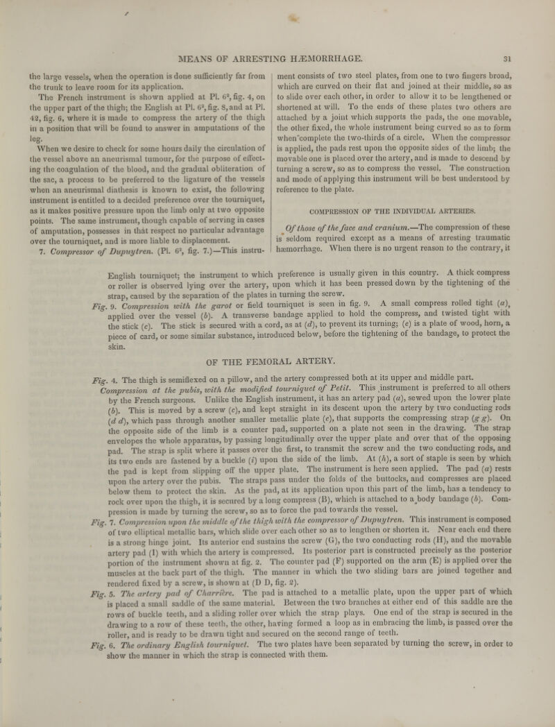 the large vessels, when the operation is done sufficiently far from the trunk to leave room for its application. The French instrument is shown applied at PI. 62, fig. 4, on the upper part of the thigh; the English at, PL 62, fig. S,and at PI. 42, fig. 6, where it is made to compress the artery of the thigh in a position that will be found to answer in amputations of the leg. When we desire to check for some hours daily the circulation of the vessel above an aneurismal tumour, for the purpose of effect- ing the coagulation of the blood, and the gradual obliteration of the sac, a process to be preferred to the ligature of the vessels when an aneurismal diathesis is known to exist, the following instrument is entitled to a decided preference over the tourniquet, as it makes positive pressure upon the limb only at two opposite points. The same instrument, though capable of serving in cases of amputation, possesses in that respect no particular advantage over the tourniquet, and is more liable to displacement. 7. Compressor of Dupuytren. (PL 62, fig. 7.)—This instru- ment consists of two steel plates, from one to two fingers broad, which are curved on their flat and joined at their middle, so as to slide over each other, in order to allow it to be lengthened or shortened at will. To the ends of these plates two others are attached by a joint which supports the pads, the one movable, the other fixed, the whole instrument being curved so as to form whencomplete the two-thirds of a circle. When the compressor is applied, the pads rest upon the opposite sides of the limb; the movable one is placed over the artery, and is made to descend by turning a screw, so as to compress the vessel. The construction and mode of applying this instrument will be best understood by reference to the plate. COMPRESSION OF THE INDIVIDUAL ARTERIES. Of those of the face and cranium.—The compression of these is'seldom required except as a means of arresting traumatic haemorrhage. When there is no urgent reason to the contrary, it English tourniquet; the instrument to which preference is usually given in this country. A thick compress or roller is observed lying over the artery, upon which it has been pressed down by the tightening of the strap, caused by the separation of the plates in turning the screw. Fig. 9. Compression with the garot or field tourniquet is seen in fig. 9. A small compress rolled tight (a), applied over the vessel (5). A transverse bandage applied to hold the compress, and twisted tight with the stick (c). The stick is secured with a cord, as at (d), to prevent its turning; (e) is a plate of wood, horn, a piece of card, or some similar substance, introduced below, before the tightening of the bandage, to protect the skin. OF THE FEMORAL ARTERY. Fig. 4. The thigh is semiflexed on a pillow, and the artery compressed both at its upper and middle part. Compression at the pubis, with the modified tourniquet of Petit. This instrument is preferred to all others by the French surgeons. Unlike the English instrument, it has an artery pad (a), sewed upon the lower plate (b). This is moved by a screw (c), and kept straight in its descent upon the artery by two conducting rods (d d), which pass through another smaller metallic plate (e), that supports the compressing strap (g g). On the opposite side of the limb is a counter pad, supported on a plate not seen in the drawing. The strap envelopes the whole apparatus, by passing longitudinally over the upper plate and over that of the opposing pad. The strap is split where it passes over the first, to transmit the screw and the two conducting rods, and its two ends are fastened by a buckle (*) upon the side of the limb. At (h), a sort of staple is seen by which the pad is kept from slipping off the upper plate. The instrument is here seen applied. The pad (a) rests upon the artery over the pubis. The straps pass under the folds of the buttocks, and compresses are placed below them to protect the skin. As the pad, at its application upon this part of the limb, has a tendency to rock over upon the thigh, it is secured by a long compress (B), which is attached to ajaody bandage (h). Com- pression is made by turning the screw, so as to force the pad towards the vessel. Fig. 7. Compression upon the middle of the thigh with the compressor of Dupuytren. This instrument is composed of two elliptical metallic bars, which slide over each other so as to lengthen or shorten it. Near each end there is a strong hinge joint. Its anterior end sustains the screw (G), the two conducting rods (H), and the movable artery pad (I) with which the artery is compressed. Its posterior part is constructed precisely as the posterior portion of the instrument shown at fig. 2. The counter pad (F) supported on the arm (E) is applied over the muscles at the back part of the thigh. The manner in which the two sliding bars are joined together and rendered fixed by a screw, is shown at (D D, fig. 2). Fig. 5. The artery pad of Charrilre. The pad is attached to a metallic plate, upon the upper part of which is placed a small saddle of the same material. Between the two branches at either end of this saddle are the rows of buckle teeth, and a sliding roller over which the strap plays. One end of the strap is secured in the drawing to a row of these teeth, the other, having formed a loop as in embracing the limb, is passed over the roller, and is ready to be drawn tight and secured on the second range of teeth. Fig. 6. The ordinary English tourniquet. The two plates have been separated by turning the screw, in order to show the manner in which the strap is connected with them.