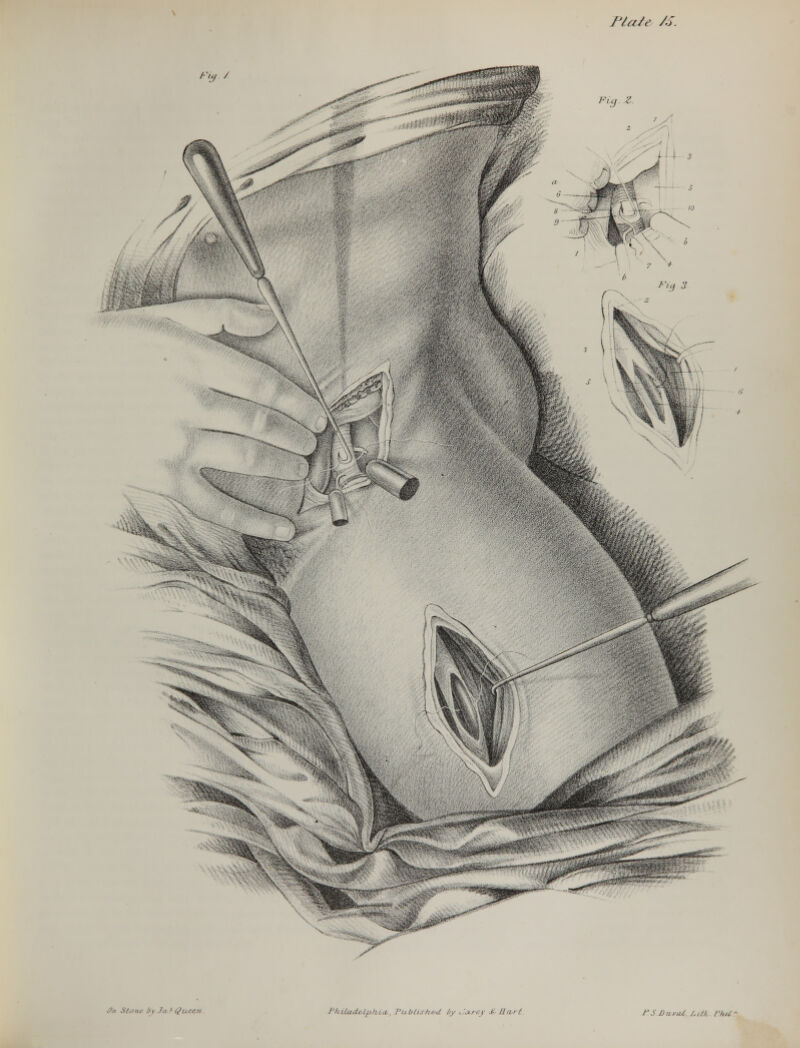 Tlale //. /'S DaicU /.ilk BhU: